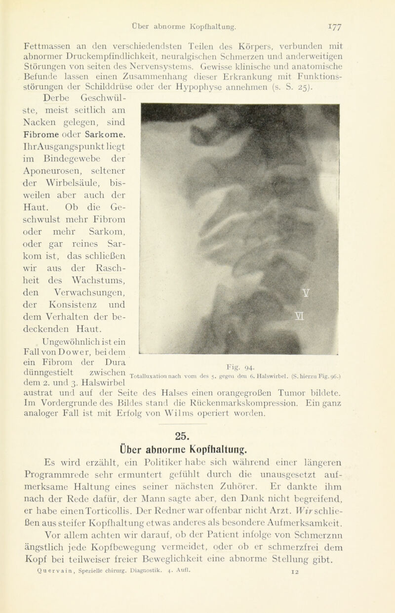 Fettmassen an den verschiedendsten Teilen des Körpers, verbunden mit abnormer Druckempfindlichkeit, neuralgischen Schmerzen und anderweitigen Störungen von seiten des Nervensystems. Gewisse klinische und anatomische Befunde lassen einen Zusammenhang dieser Erkrankung mit Funktions- störungen der Schilddrüse oder der Hypophyse annehmen (s. S. 25). Derbe Geschwül- ste, meist seitlich am Nacken gelegen, sind Fibrome oder Sarkome. Ihr Ausgangspunkt liegt im Bindegewebe der Aponeurosen, seltener der Wirbelsäule, bis- weilen aber auch der Haut. Ob die Ge- schwulst mehr Fibrom oder mehr Sarkom, oder gar reines Sar- das schließen der Rasch- Wachstums, V erwach sungen, kom ist, wir aus heit des den der Konsistenz und dem Verhalten der be- deckenden Haut. Ungewöhnlich ist ein Fall von Do wer, bei dem ein Fibrom der Dura dünngestielt zwischen dem 2. und 3. Halswirbel austrat und auf der Seite des Halses einen orangegroßen Tumor bildete. Im Vordergründe des Bildes stand die Rückenmarkskompression. Ein ganz analoger Fall ist mit Erfolg von Wilms operiert worden. Fig. 94- Totalluxation nach vorn des 5. gegen den 6. Halswirbel. (S. hierzu Fig. 96.) 25. Über abnorme Kopfhaltung. Es wird erzählt, ein Politiker habe sich während einer längeren Programmrede sehr ermuntert gefühlt durch die unausgesetzt auf- merksame Haltung eines seiner nächsten Zuhörer. Er dankte ihm nach der Rede dafür, der Mann sagte aber, den Dank nicht begreifend, er habe eincnTorticollis. Der Redner war offenbar nicht Arzt. Wir schlie- ßen aus steifer Kopfhaltung etwas anderes als besondere Aufmerksamkeit. Vor allem achten wir darauf, ob der Patient infolge von Schmerznn ängstlich jede Kopfbewegung vermeidet, oder ob er schmerzfrei dem Kopf bei teilweiser freier Beweglichkeit eine abnorme Stellung gibt. Quervain, Spezielle Chirurg. Diagnostik. 4. Aufl. 12