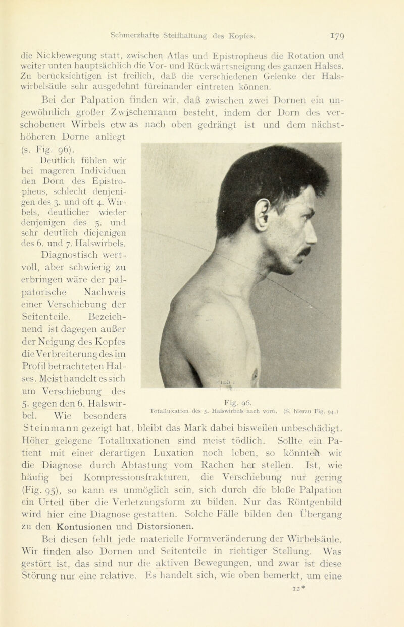 die Nickbewegung statt, zwischen Atlas und Epistropheus die Rotation und weiter unten hauptsächlich die Vor- und Rückwärtsneigung des ganzen Halses. Zu berücksichtigen ist freilich, daß die verschiedenen Gelenke der Hals- wirbelsäule sehr ausgedehnt füreinander eintreten können. Bei der Palpation finden wir, daß zwischen zwei Dornen ein un- gewöhnlich großer Zwischenraum besteht, indem der Dorn des ver- schobenen Wirbels etw as nach oben gedrängt ist und dem nächst- höheren Dorne anliegt (s. Fig. 96). Deutlich fühlen wir bei mageren Individuen den Dorn des Epistro- pheus, schlecht denjeni- gen des 3. und oft 4. Wir- bels, deutlicher wieder denjenigen des 5. und sehr deutlich diejenigen des 6. und 7. Halswirbels. Diagnostisch wert- voll, aber schwierig zu erbringen wäre der pal- patorische Nachweis einer Verschiebung der Seitenteile. Bezeich- nend ist dagegen außer der Neigung des Kopfes die Verbreiterung des im Profil betrachteten Hal- ses. Meist handelt es sich um Verschiebung des 5. gegen den 6. Halswir- bel. Wie besonders Fig. 96. Totalluxation des 5. Halswirbels nach vorn. (S. hierzu Fig. 94.) Steinmann gezeigt hat, bleibt das Mark dabei bisweilen unbeschädigt. Höher gelegene Totalluxationen sind meist tödlich. Sollte ein Pa- tient mit einer derartigen Luxation noch leben, so könnt eh wir die Diagnose durch Abtastung vom Rachen her stellen. Ist, wie häufig bei Kompressionsfrakturen, die Verschiebung nur gering (Fig. 95), so kann es unmöglich sein, sich durch die bloße Palpation ein Urteil über die Verletzungsform zu bilden. Nur das Röntgenbild wird hier eine Diagnose gestatten. Solche Fälle bilden den Übergang zu den Kontusionen und Distorsionen. Bei diesen fehlt jede materielle Form Veränderung der Wirbelsäule. Wir finden also Dornen und Seitenteile in richtiger Stellung. Was gestört ist, das sind nur die aktiven Bewegungen, und zwar ist diese Störung nur eine relative. Es handelt sich, wie oben bemerkt, um eine