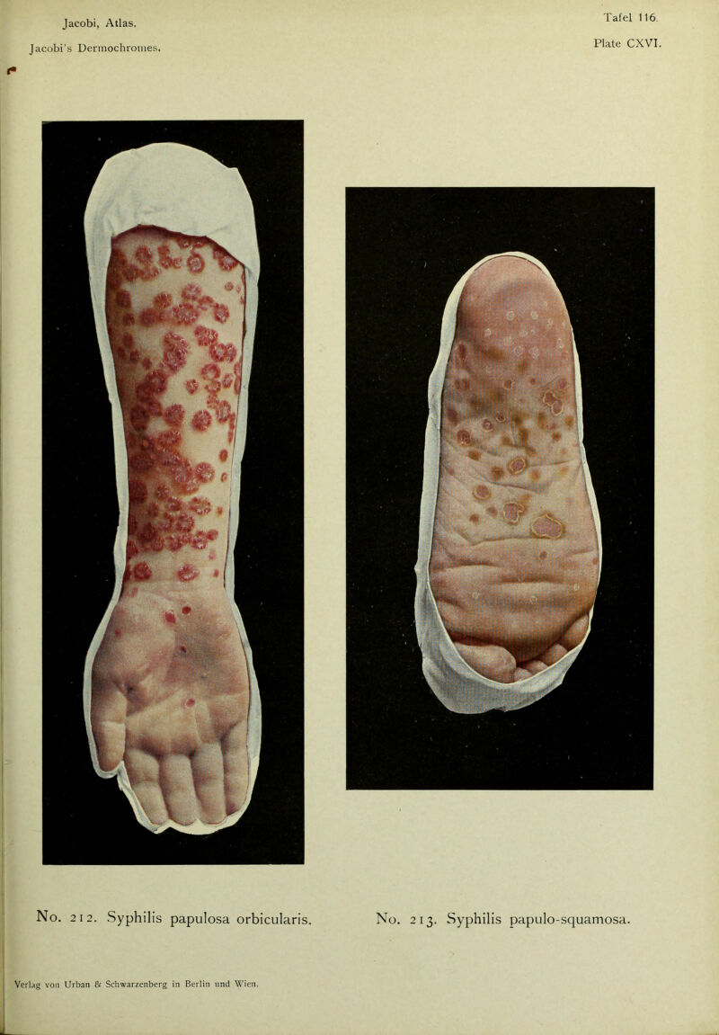 Jacobi, Atlas. Jacobi’s Dermochromes. t* Plate CXVI.
