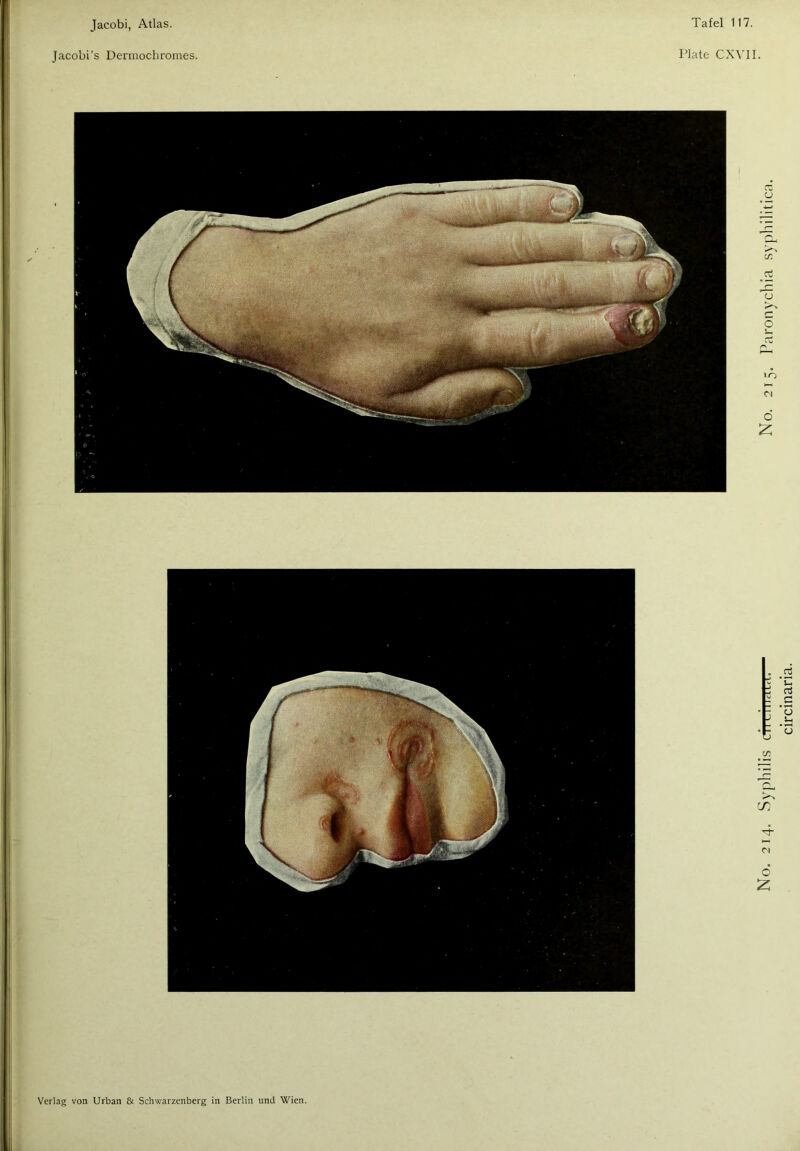 Jacobi’s Dermochromes. Plate CXYII.