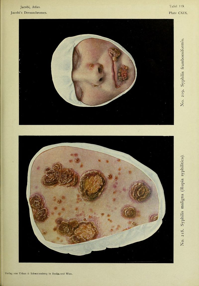 Tafel 119. Jacobi’s Dermochromes. Plate CXIX.