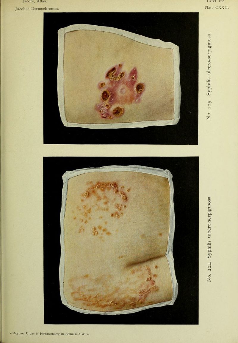 Jacobi’s Dermochromes. Plate CXXII. aj C/3 0 ’5c a ]_ 0) C/3 1 O u <u CJ t/3 15 O, C/) LO 03 6 £ b/D ’Qh Ui OJ c/3 i O !_ <L> J=> 3 c/3 15 a, cn ■4 <N et O £