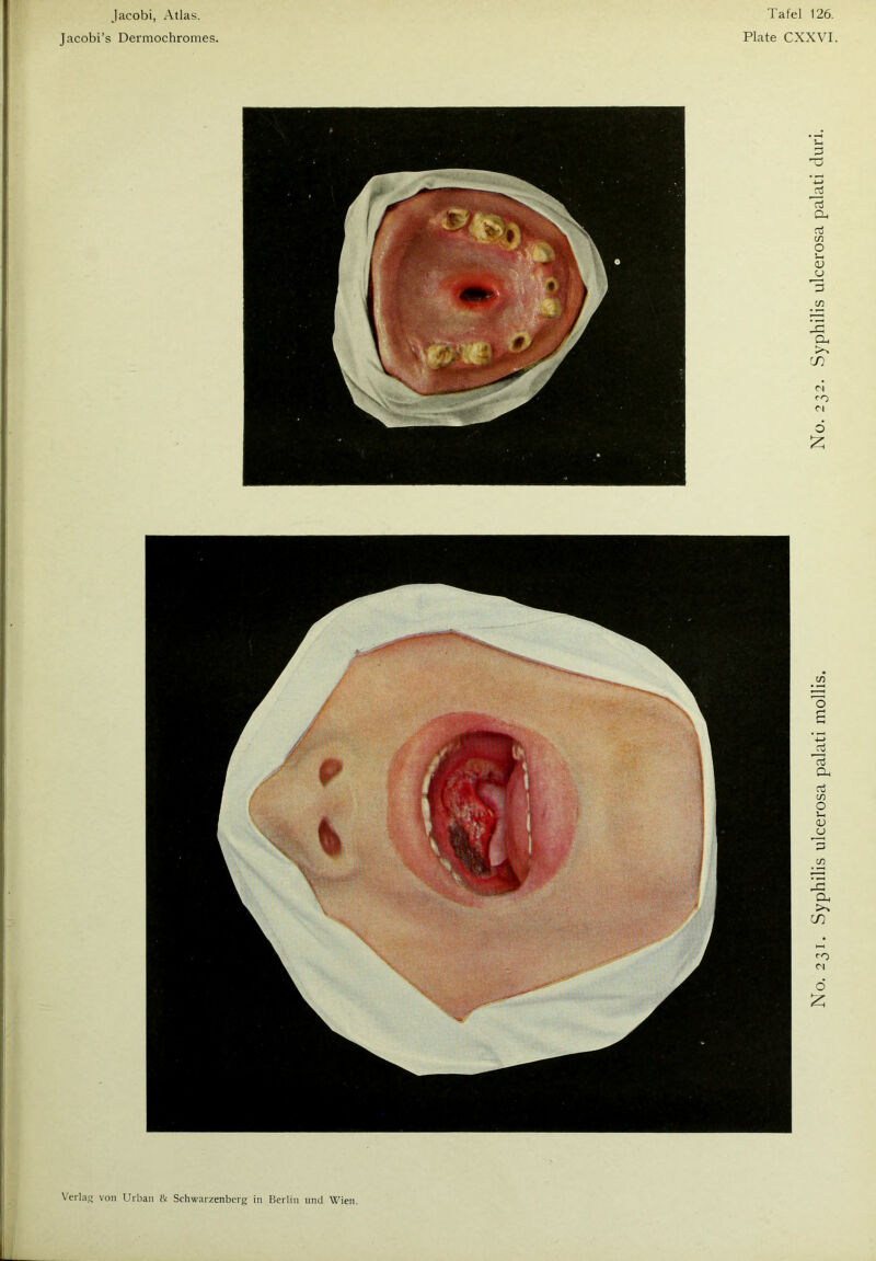 Jacobi’s Dermochromes. Plate CXXVI.