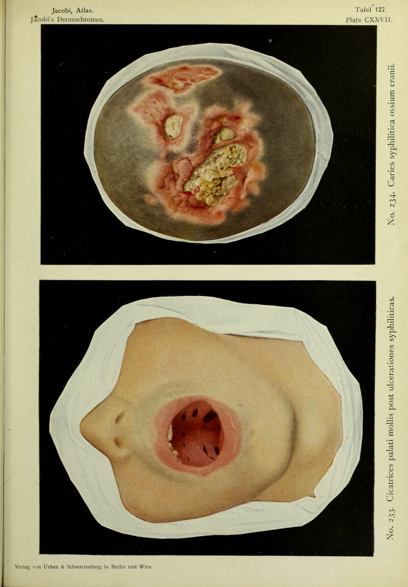 Tafel 127. Plate CXXVII. Jacobi, Atlas. Jacobi’s Dermochromes.