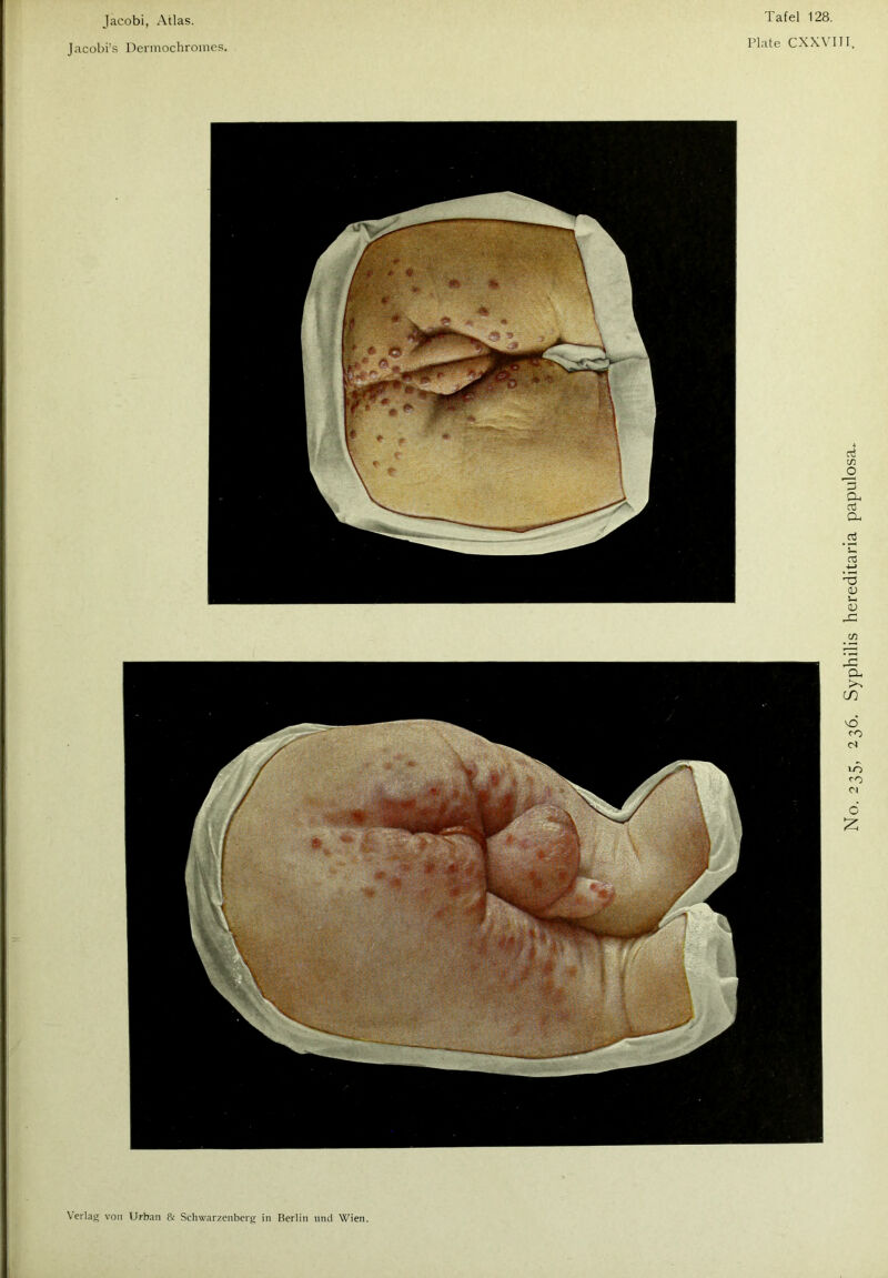 Jacobi’s Dermochromes. Tafel 128. Plate CXXVIJI.
