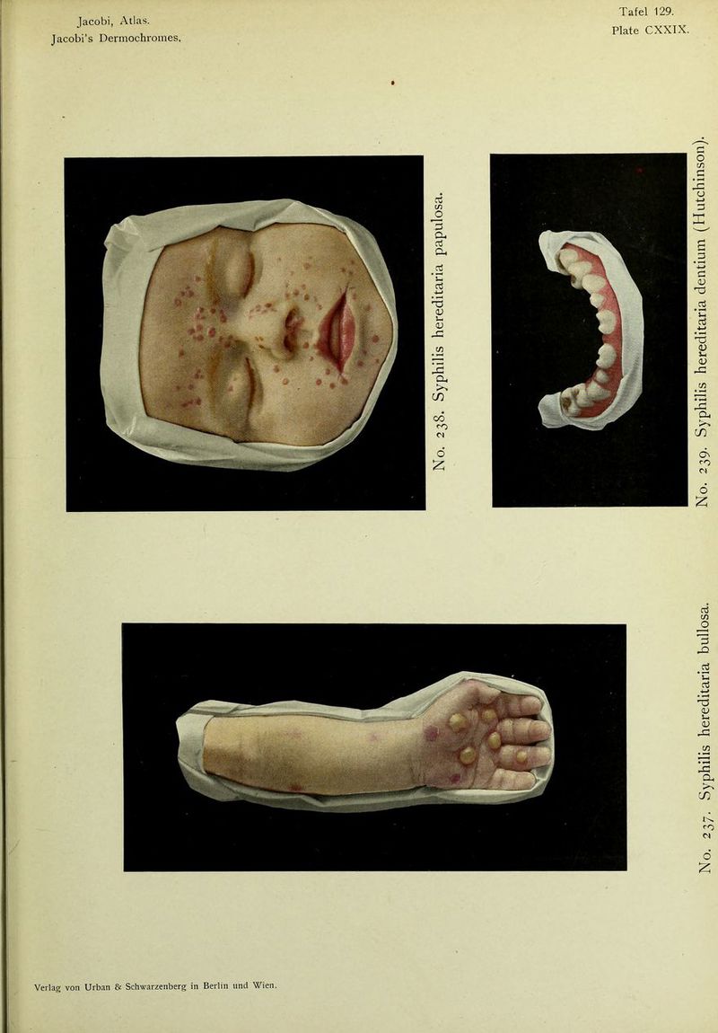 Jacobi’s Dermochromes. Tafel 129. Plate CXXIX. »