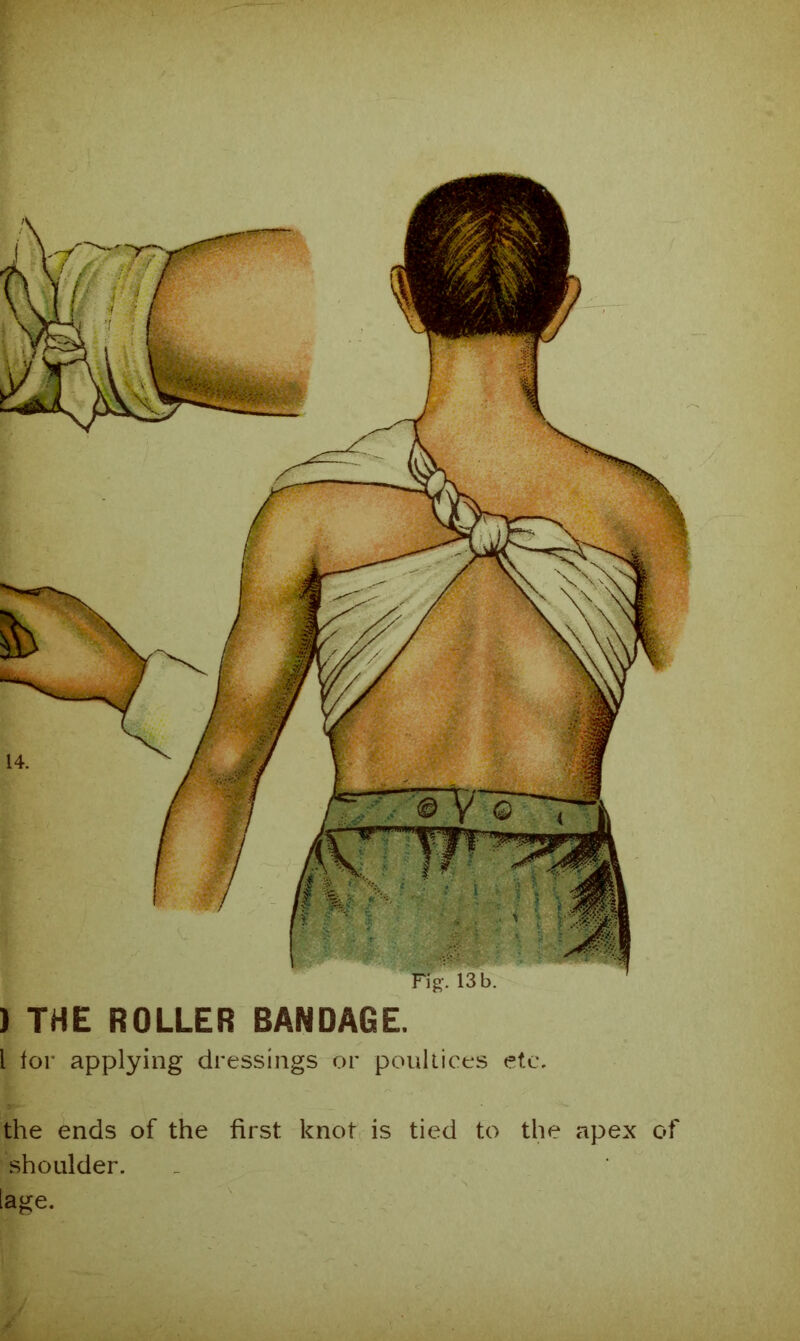 ) THE ROLLER BANDAGE. l for applying dressings or poultices etc. the ends of the first knot is tied to the apex of shoulder, lage.