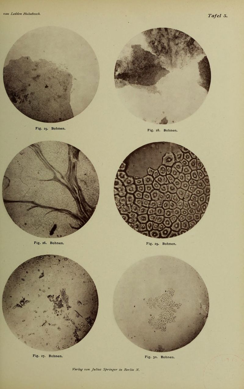 Tafel o, Fig. 25. Bohnen. Fig. 28. Bohnen. Fig. 29. Bohnen. Fig. 26. Bohnen. I Fig. 27. Bohnen. Fig. 30. Bohnen.