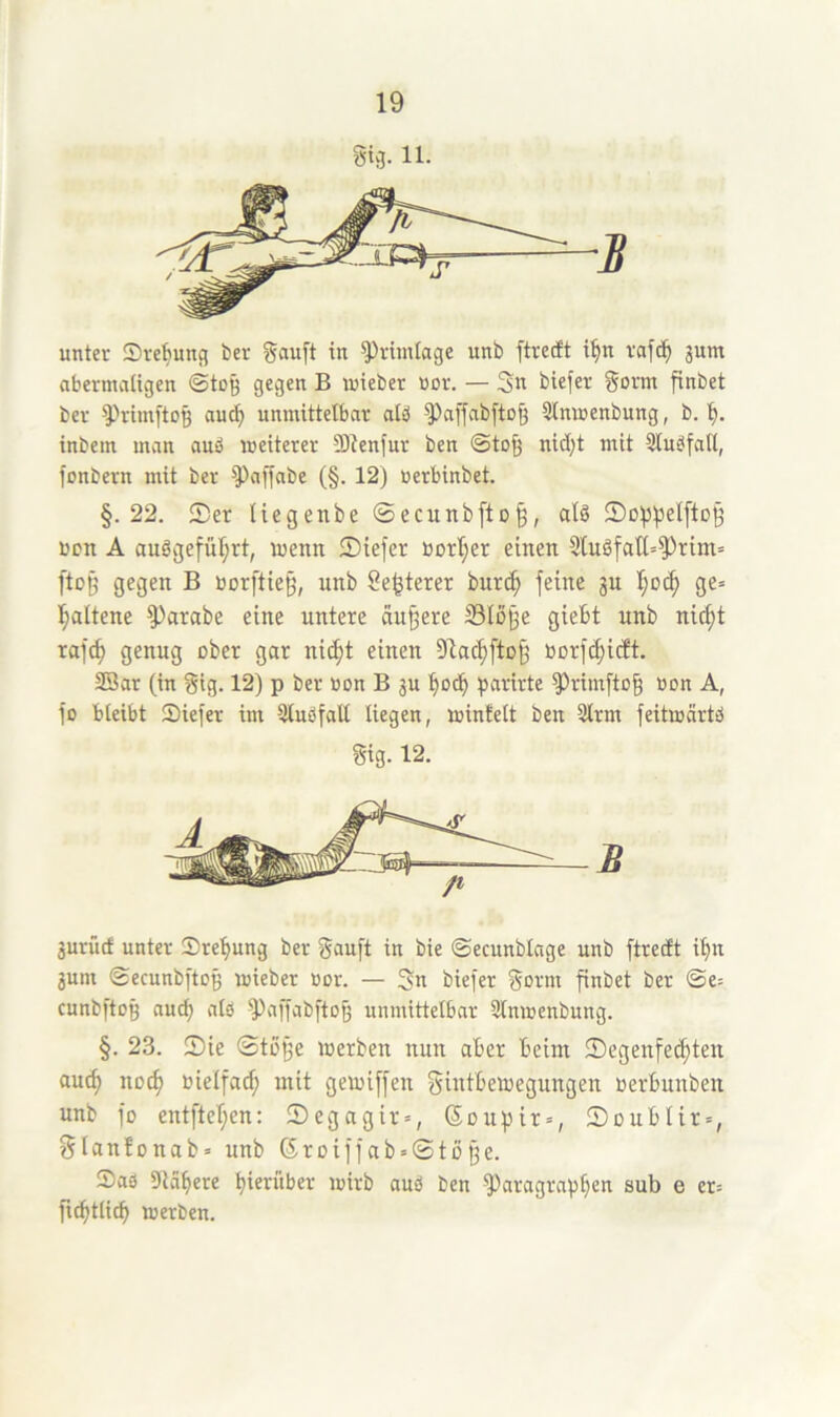 gijj. 11. unter Svebunfl ber gauft in ^vimtage unb ftrecft i^n vafc^ 3um abermaligen ©tog gegen B mieber »or. — 3n biefer gorm finbet ber ^H-irnftoß au^ unmittelbar alb ^affabfto^ ülnmenbung, b. inbem man aub weiterer Slienfur ben ©to§ nid;t mit Slubfall, fonbern mit ber ^Paj|abe (§. 12) nerbinbet. §.22. Ser liegenbe ©ecunbfto^, alb Sü)))3eI[tD^ öcn A aubgefül;rt, wenn Siefer borI)er einen 2tubfatl=^rim= ftoß gegen B »orftieß, unb Se^terer bur(^ feine ju ge= l^altene ^arabe eine untere äußere S3Iö§e giebt unb nic^t rafc^ genug ober gar ni(^t einen 91ac^fto^ »orf(^itft. 23ar (in gig. 12) p ber üon B ju bocb parirte ^rimfto§ öon A, fo bleibt ®iefer im Slubfall liegen, wintelt ben 2lrm feitwärtb gig. 12. jurücf unter Sre^ung ber gauft in bie ©ecunblage unb ftrecft i^n jum ©ecunbftoß wieber üor. — 3n biefer ^orm finbet ber ©e= cunbftog aucf) alb ^affabftoi) unmittelbar ütnwenbung. §. 23. Sie 0tö§e werben nun aber beim Segenfec^ten auc^ nocf> oielfac^ mit gewiffen gintbewegungen oerbunben unb fo entftel)en: Segagir», ßoupir», Soublir«, glanfonab» unb ßroiffab»©to§e. Sab Slabere hierüber wirb aub ben Paragraphen sub e er= fuhtlich werben.