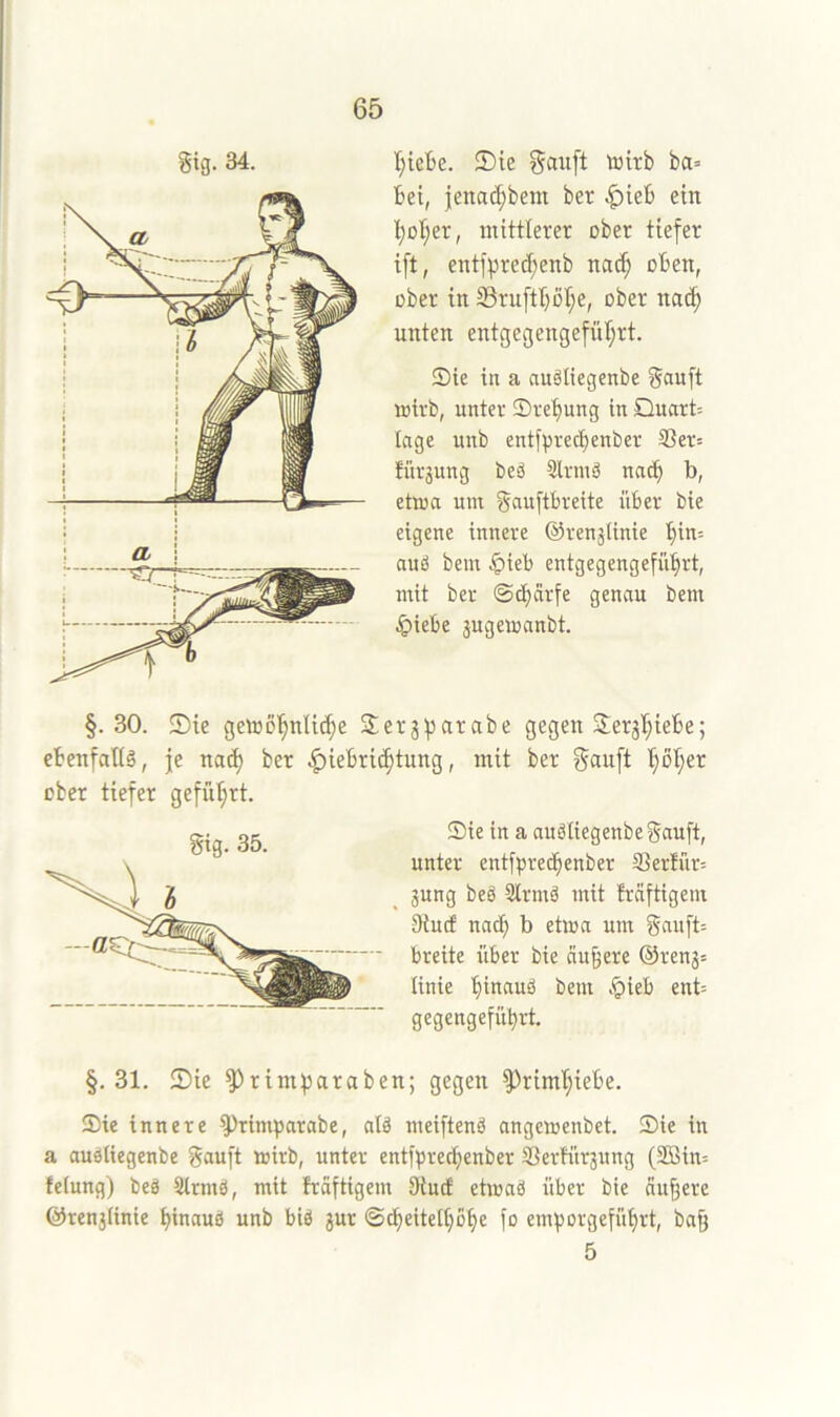 gig. 34. I}ieBe. Sie gauft wirb ba» Bei, |ena(^bem ber .^ieB ein ]^Di;er, mittlerer ober tiefer ift, entf^red;enb nacf; oBen, ober in 23ruftI}oI;e, ober nac^ unten entgegengefül;rt. Sie in a nuäliegenbe gnuft wirb, unter Sret)ung in Quart= tage unb entfprecBenber S3er= für3ung beö 3^lrniä na^ b, etwa um gauftBveite üBer bie eigene innere ©renälinie I}in= auö bem .^icB entgegengefüBrt, mit ber ©d;cirfe genau bem 4>ieBe jugewanbt. §.30. ®ie gewo'^nlic^e Serjparabe gegen SerjI^ieBe; eBenfaltä, je nad) ber ^ieBric^tnng, mit ber gauft l§ol;er ober tiefer gefüf;rt. Sie in a auäliegenbegauft, unter entfpret^enber 33ertiir= jung beg Strmä mit fräftigem 9iucf nacj) b etwa um gau[t= breite über bie äußere ©renj= Itnie Binauö bem .^ieb ent-- gegengefüBrt, §.31. Sie ^rimparaben; gegen 5^rimT;ieBe. Sie innere ^rimparabe, alä meifteng angewenbet. Sie in a augliegenbe gauft wirb, unter entf^recBenber SSerKirjung (2Bin= fe(ung) beg Sirmg, mit fräftigem 9iucf etwag über bie äußere ©renjiinie Binaug unb big jur ©cBeiteltjoBe fo emBorgefüBrt, ba& 5