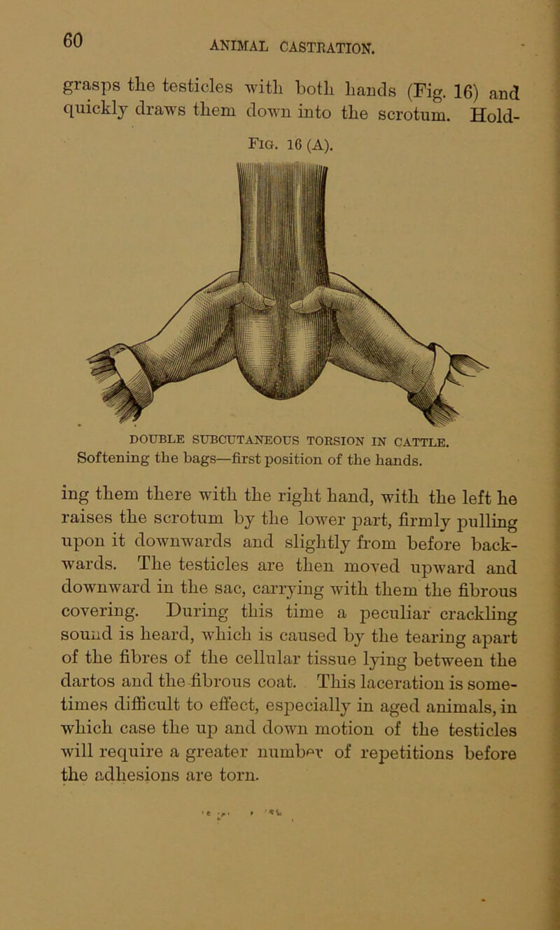 grasps the testicles with both hands (Fig. 16) and quickly draws them down into the scrotum. Hold- Fig. 16(A). DOUBLE SUBCUTANEOUS TORSION IN CATTLE. Softening the bags—first position of the hands. ing them there with the right hand, with the left he raises the scrotum by the lower part, firmly pulling upon it downwards and slightly from before back- wards. The testicles are then moved upward and downward in the sac, carrying with them the fibrous covering. During this time a peculiar crackling sound is heard, which is caused by the tearing apart of the fibres of the cellular tissue lying between the dartos and the fibrous coat. This laceration is some- times difficult to effect, especially in aged animals, in which case the up and down motion of the testicles will require a greater number of repetitions before the adhesions are torn.
