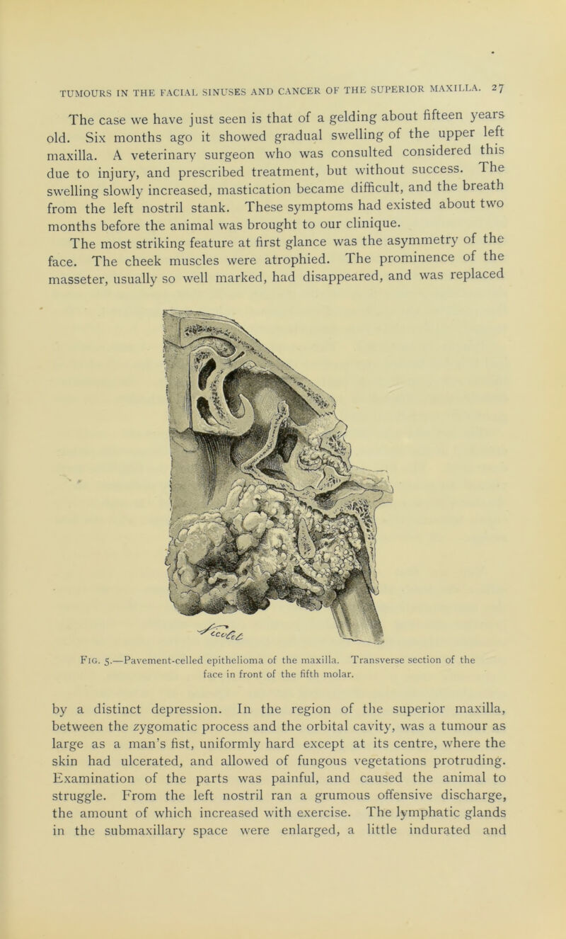 The case we hâve just seen is that of a gelding about fïfteen yeais old. Six months ago it showed graduai swelling of the upper left maxilla. A veterinary surgeon who was consulted considered this due to injury, and prescribed treatment, but without success. The swelling slowly increased, mastication became difficult, and the breath from the left nostril stank. These symptoms had existed about two months before the animal was brought to our clinique. The most striking feature at first glance was the asymmetry of the face. The cheek muscles were atrophied. The prominence of the masseter, usually so well marked, had disappeared, and was ieplaced Fig. 5.—Pavement-celled epithelioma of the maxilla. Transverse section of the face in front of the fifth molar. by a distinct dépréssion. In the région of the superior maxilla, between the zygomatic process and the orbital cavity, was a tumour as large as a man’s fist, uniformly hard except at its centre, where the skin had ulcerated, and allowed of fungous végétations protruding. Examination of the parts was painful, and caused the animal to struggle. From the left nostril ran a grumous offensive discharge, the amount of which increased with exercise. The lymphatic glands in the submaxillary space were enlarged, a little indurated and