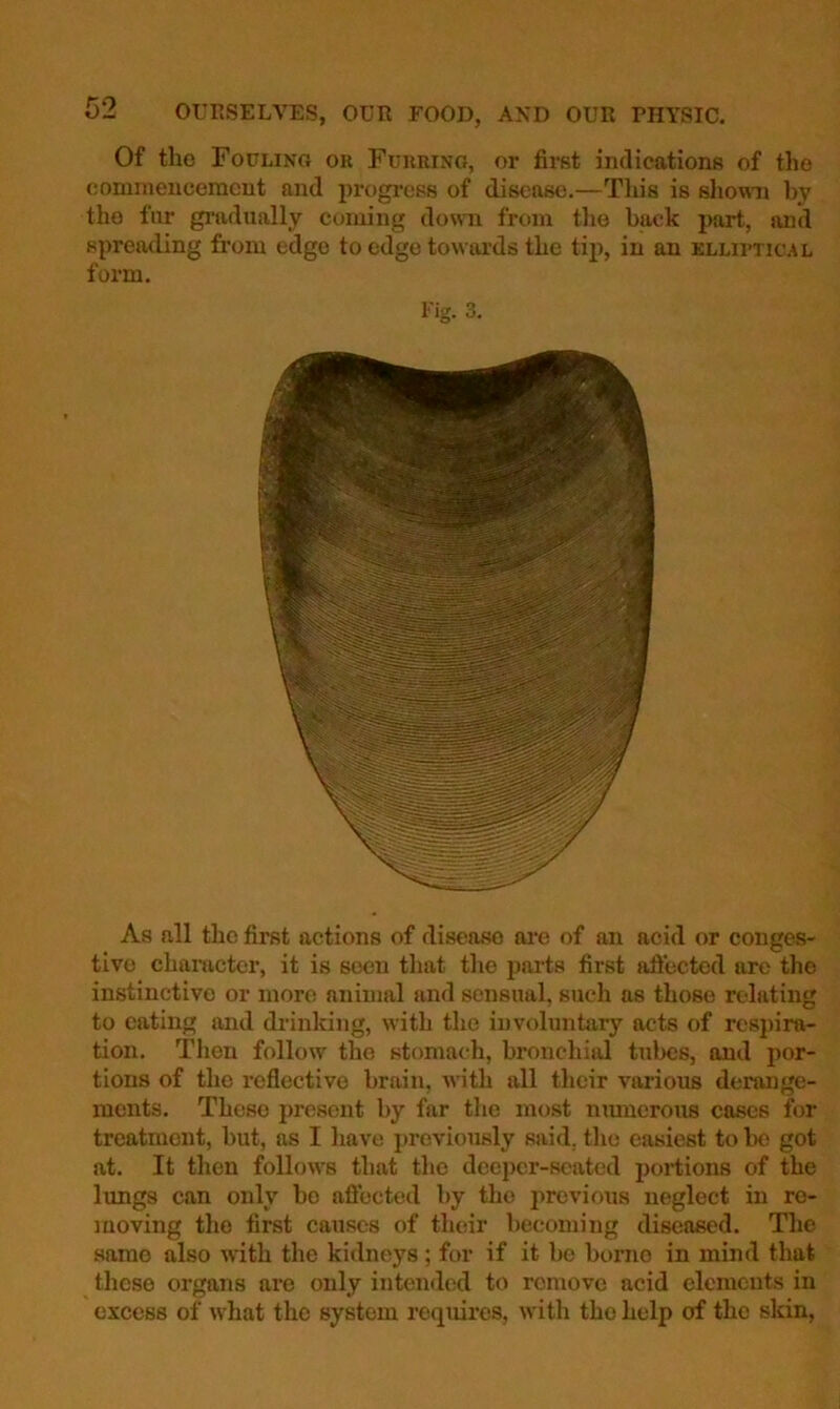 Of the Focling or Furring, or first indications of the eominencemcnt and progi-ess of disease.—Tliis is shown by the fiir gradually coming down from tlie hack part, and spreading finm edge to edge towards the tip, in an elliptical form. Fig. 3. As all the first actions of disease are of an acid or conges- tive character, it is seen that the parts first aftected are the instinctive or more animal and sensual, such as those relating to eating and diinking, with the involuntary acts of respira- tion. Then follow the stomach, bronchial tubes, and por- tions of the reflective brain, with all their various derange- ments. These jiresent by far the most nranerous cases for treatment, hut, as I have previously said, the easiest to be got at. It then follows that the deeper-seated portions of the limgs can only bo aftected by the previous neglect in re- moving the first causes of their becoming diseased. The same also with the kidneys; for if it be borne in mind that these organs are only intended to remove acid elements in excess of what the system requires, with the help of the skin,