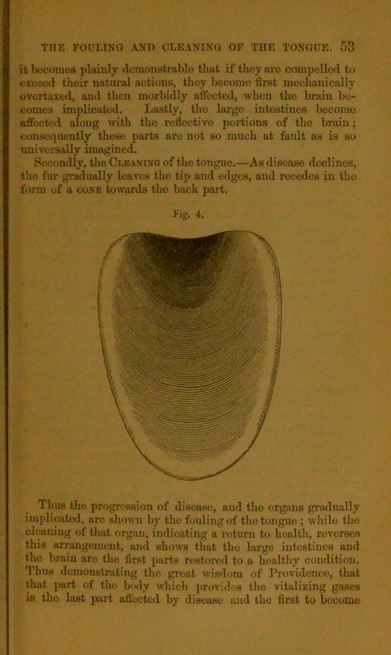 THE FOULING AND CLEANING OF THE TONGUE. 58 it becomes plainly demonstrablo that if they are comj)olled to e.x;cootl their uatm-al actions, they become first mechanically overtaxed, and then morbidly attbeted, when the brain be- comes implicated. Lastly, tlio largo intestines become affected along with the reflective portions of the brain; consequently tliese parts arc not so much at fault as is so universally imagined. Soconflly, the Cceanino of the tongue.—As disease declines, the fur gradually leaves the tip and edges, and recedes in the form of a cone towards the back pai t. Fig. 4. Thus the progression of disease, and the organs gradually implicated, are shown by the fouling of the tongue ; while the cleaning of tluit organ, indicating a return to health, reverses this arrangement, and shows that tho large intestines and the brain are tho first parts restorcil to a healthy condition. Tims demonstrating the great wisdom of Providence, that that part of tho btaly which provides tho vitalizing gases is tho last part affected by disease and tho first to become
