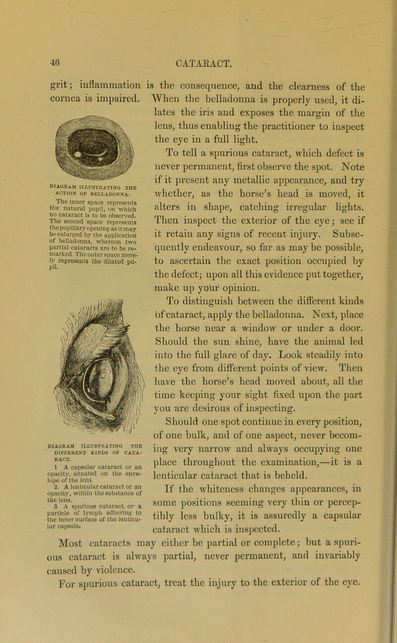 iff, M diagram illustrating the ACTION OF BELLADONNA. The inner space represents the natural pupil, on which no cataract is to be observed. The second space represents the pupillary opening as it may be enlarged by the application of belladonna, whereon two partial cataracts are to be re- marked, The outer space mere- ly represents the dilated pu- pil. grit; inflammation is the consequence, and the clearness of the cornea is impaired. When the belladonna is properly used, it di- lates the iris and exposes the margin of the lens, thus enabling the practitioner to inspect the eye in a full light. To tell a spurious cataract, which defect is never permanent, first observe the spot. Note if it present any metallic appearance, and try whether, as the horse’s head is moved, it alters in shape, catching ii’regular lights. Then inspect the exterior of the eye; see if it retain any signs of recent injury. Subse- quently endeavour, so far as may be possible, to ascertain the exact position occupied by the defect; upon all this evidence put together, make up your opinion. To distinguish between the different kinds of cataract, apply the belladonna. Next, place the horse near a window or under a door. Should the sun shine, have the animal led into the full glare of day. Look steadily into the eye from different points of view. Then have the horse’s head moved about, all the time keeping your sight fixed upon the part you are desirous of inspecting. Should one spot continue in every position, of one hulk, and of one aspect, never becom- ing very narrow and always occupying one place throughout the examination,—it is a lenticular cataract that is beheld. If the whiteness changes appearances, in some positions seeming very thin or percep- tibly less bulky, it is assuredly a capsular cataract which is inspected. Most cataracts may either be partial or complete; but a spuri- ous cataract is always partial, never permanent, and invariably caused by violence. For spurious cataract, treat the injury to the exterior of the eye. DIAGRAM ILLU9TRATINQ THE DIFFERENT KINDS OF CATA- RACT. 1 A capsular cataract or an opacity, situated on the enve- lope of the lens. 2. A lenticular cataract or an opacity, within the substance of the lens. 3 A spurious cataract, or- a particle of lymph adhering to the inner surface of the lenticu- lar capsule.