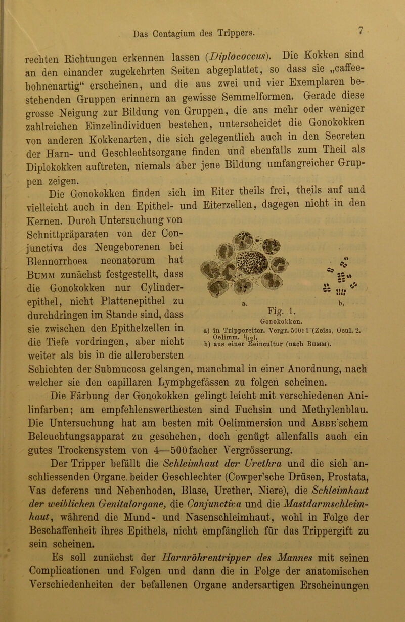 Das Contagium des Trippers. * rechten Richtungen erkennen lassen (Diplococcus). Die Kokken sind an den einander zugekehrten Seiten abgeplattet, so dass sie „caffee- bohnenartig“ erscheinen, und die aus zwei und vier Exemplaren be- stehenden Gruppen erinnern an gewisse Semmelformen. Gerade diese grosse Neigung zur Bildung von Gruppen, die aus mehr oder weniger zahlreichen Einzelindividuen bestehen, unterscheidet die Gonokokken von anderen Kokkenarten, die sich gelegentlich auch in den Secieten der Harn- und Geschlechtsorgane finden und ebenfalls zum Theil als Diplokokken auftreten, niemals aber jene Bildung umfangreicher Grup- pen zeigen. Die Gonokokken finden sich im Eiter theils frei, theils auf und vielleicht auch in den Epithel- und Eiterzellen, dagegen nicht in den Kernen. Durch Untersuchung von Schnittpräparaten von der Con- junctiva des Neugeborenen bei Blennorrhoea neonatorum hat Bumm zunächst festgestellt, dass die Gonokokken nur Cylinder- epithel, nicht Plattenepithel zu durchdringen im Stande sind, dass sie zwischen den Epithelzellen in die Tiefe Vordringen, aber nicht weiter als bis in die allerobersten Schichten der Submucosa gelangen, manchmal in einer Anordnung, nach welcher sie den capillaren Lymphgefässen zu folgen scheinen. Die Färbung der Gonokokken gelingt leicht mit verschiedenen Ani- linfarben; am empfehlenswerthesten sind Fuchsin und Methylenblau. Die Untersuchung hat am besten mit Oelimmersion und AßBE’schem Beleuchtungsapparat zu geschehen, doch genügt allenfalls auch ein gutes Trockensystem von 4—500facher Vergrösserung. Der Tripper befällt die Schleimhaut der Urethra und die sich an- schliessenden Organe, beider Geschlechter (Cowper’sche Drüsen, Prostata, Vas deferens und Nebenhoden, Blase, Urether, Niere), die Schleimhaut der weiblichen Genital Organe, die Conjunctiva und die Mastdarmsclileim- haut, während die Mund- und Nasenschleimhaut, wohl in Folge der Beschaffenheit ihres Epithels, nicht empfänglich für das Trippergift zu sein scheinen. Es soll zunächst der Harnröhr entriß]) er des Mannes mit seinen Complicationen und Folgen und dann die in Folge der anatomischen Verschiedenheiten der befallenen Organe andersartigen Erscheinungen Fig. i. Gonokokken. a) in Trippereiter. Vergr. 500: 1 (Zeiss, Ocul. 2. Oelimm. V12)« b) aus einer Eeincultur (nach Bumm).