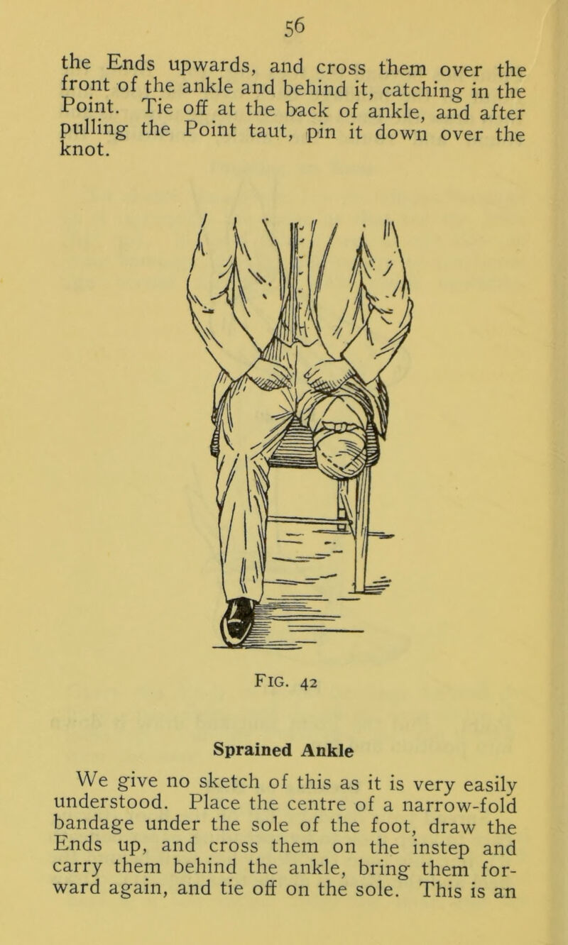 the Ends upwards, and cross them over the front of the ankle and behind it, catching in the Point. Tie off at the back of ankle, and after pulling the Point taut, pin it down over the knot. Sprained Ankle We give no sketch of this as it is very easily understood. Place the centre of a narrow-fold bandage under the sole of the foot, draw the Ends up, and cross them on the instep and carry them behind the ankle, bring them for- ward again, and tie off on the sole. This is an