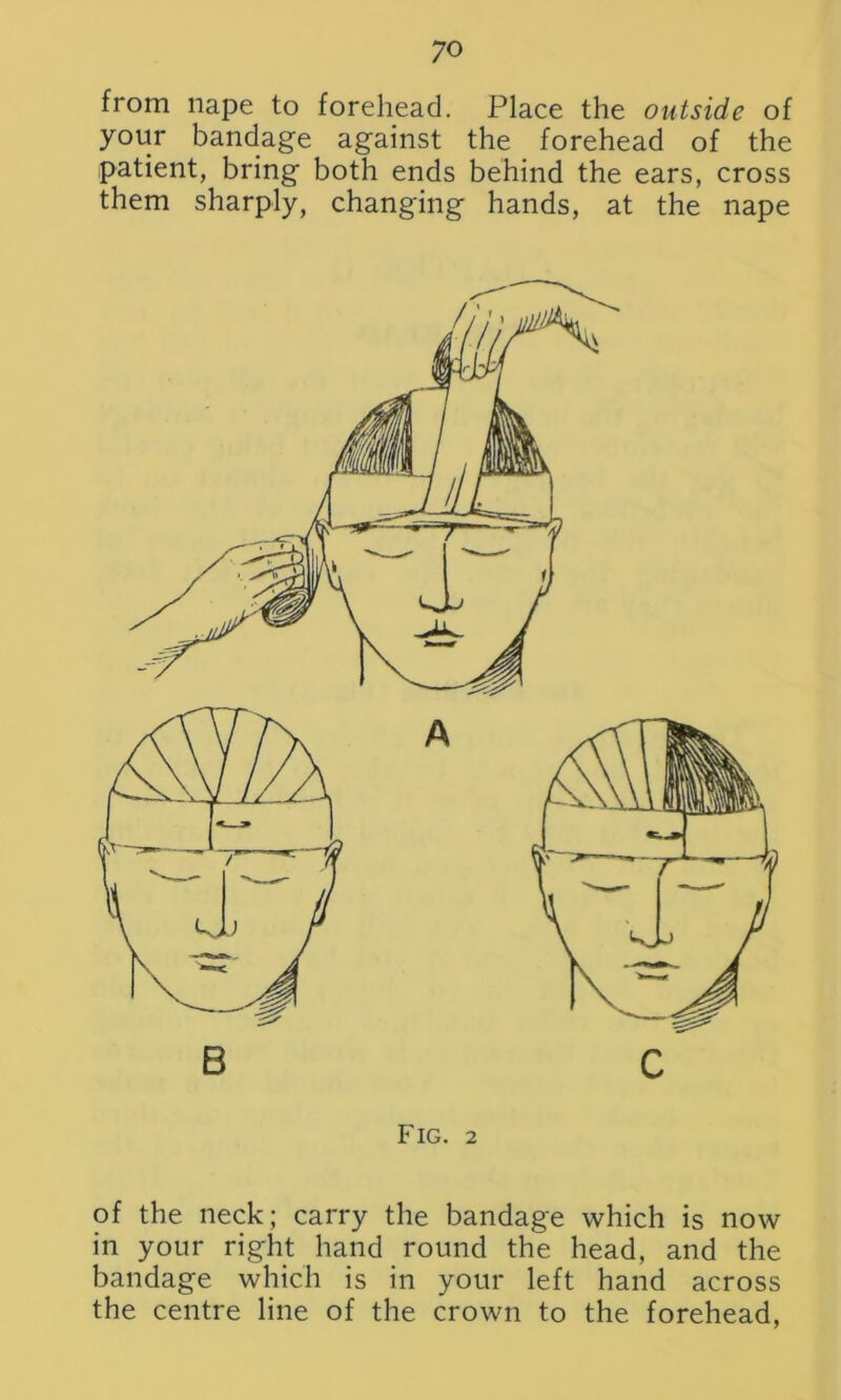 from nape to forehead. Place the outside of your bandage against the forehead of the patient, bring both ends behind the ears, cross them sharply, changing hands, at the nape A B Fig. 2 of the neck; carry the bandage which is now in your right hand round the head, and the bandage which is in your left hand across the centre line of the crown to the forehead,