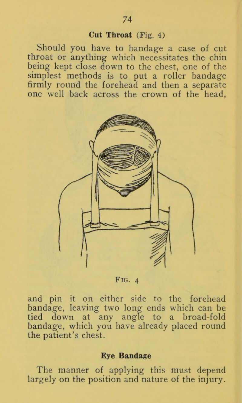 Cut Throat (Fig. 4) Should you have to bandage a case of cut throat or anything which necessitates the chin being kept close down to the chest, one of the simplest methods is to put a roller bandage firmly round the forehead and then a separate one well back across the crown of the head, Fig. 4 and pin it on either side to the forehead bandage, leaving two lone ends which can be tied down at any angle to a broad-fold bandage, which you have already placed round the patient’s chest. Eye Bandage The manner of applying this must depend largely on the position and nature of the injury.