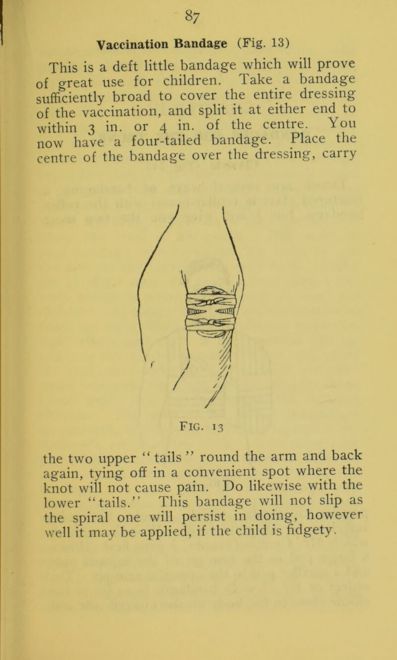 Vaccination Bandage (Fig. 13) This is a deft little bandage which will prove of o-reat use for children. Take a bandage sufficiently broad to cover the entire dressing of the vaccination, and split it at either end to within 3 in. or 4 in. of the centre. You now have a four-tailed bandage. Place the centre of the bandage over the dressing, carry the two upper “ tails ” round the arm and back again, tying off in a convenient spot where the knot will not cause pain. Do likewise with the lower “tails.” This bandage will not slip as the spiral one will persist in doing, however well it may be applied, if the child is fidgety.