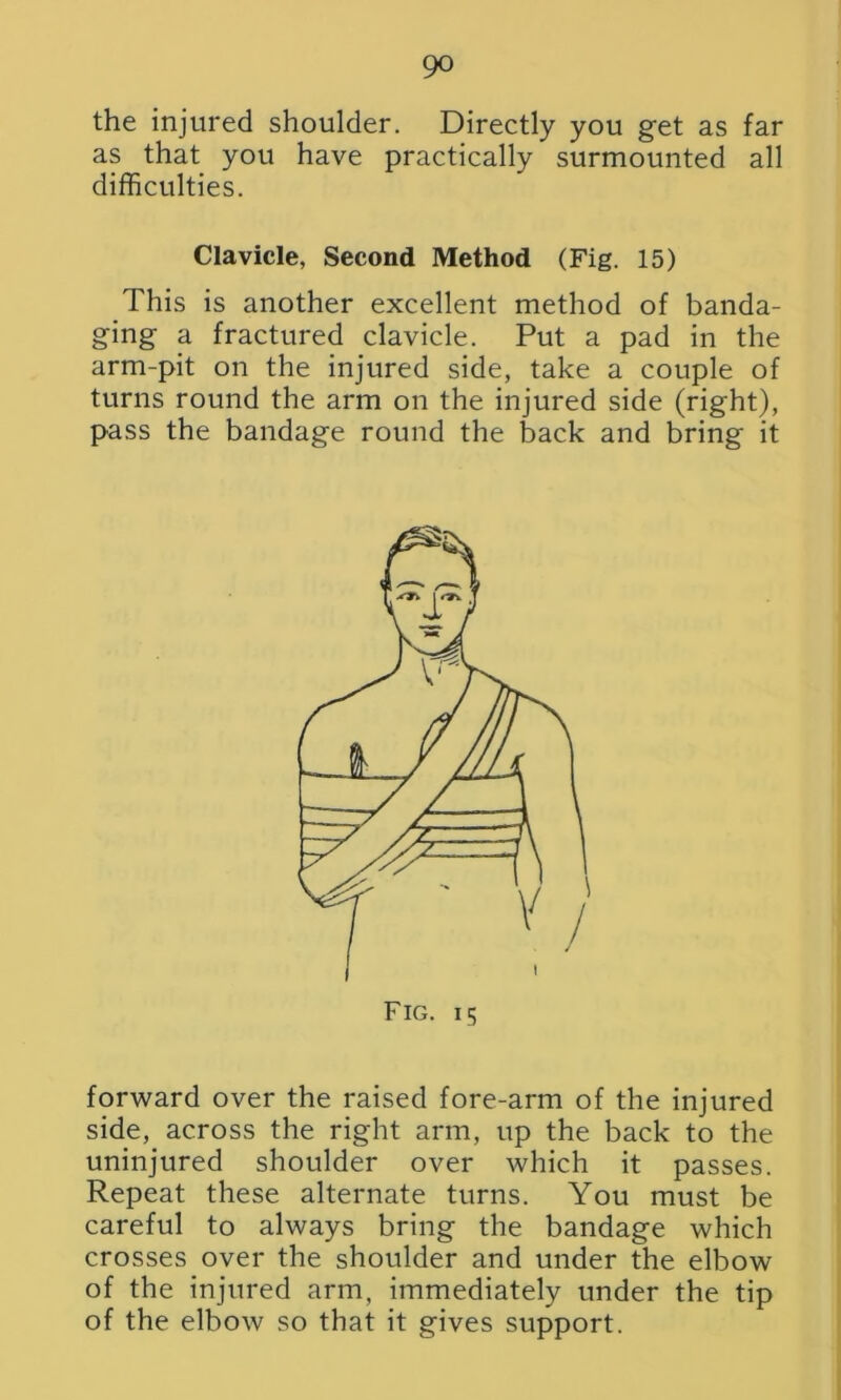 the injured shoulder. Directly you get as far as that you have practically surmounted all difficulties. Clavicle, Second Method (Fig. 15) This is another excellent method of banda- ging a fractured clavicle. Put a pad in the arm-pit on the injured side, take a couple of turns round the arm on the injured side (right), pass the bandage round the back and bring it forward over the raised fore-arm of the injured side, across the right arm, up the back to the uninjured shoulder over which it passes. Repeat these alternate turns. You must be careful to always bring the bandage which crosses over the shoulder and under the elbow of the injured arm, immediately under the tip of the elbow so that it gives support.