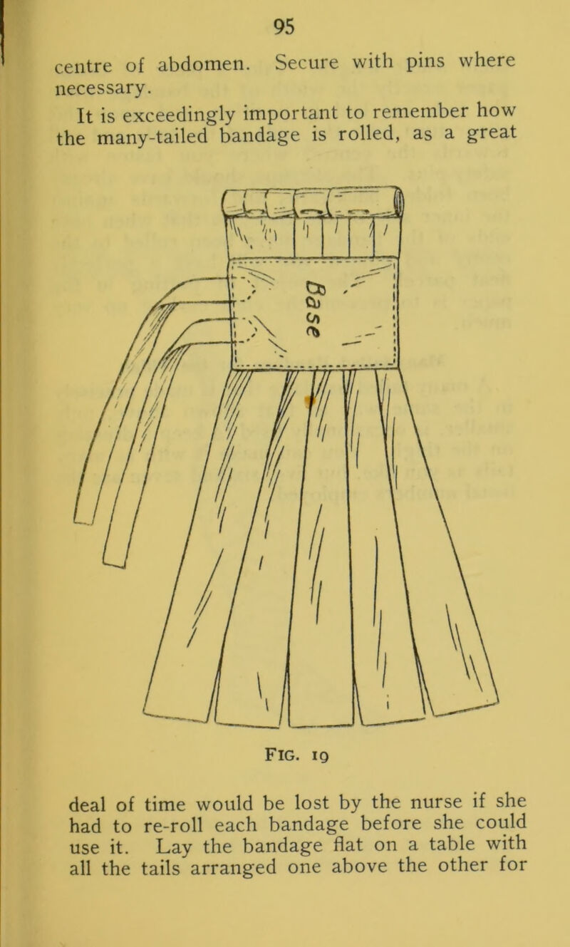 centre of abdomen. Secure with pins where necessary. It is exceedingly important to remember how the many-tailed bandage is rolled, as a great deal of time would be lost by the nurse if she had to re-roll each bandage before she could use it. Lay the bandage flat on a table with all the tails arranged one above the other for