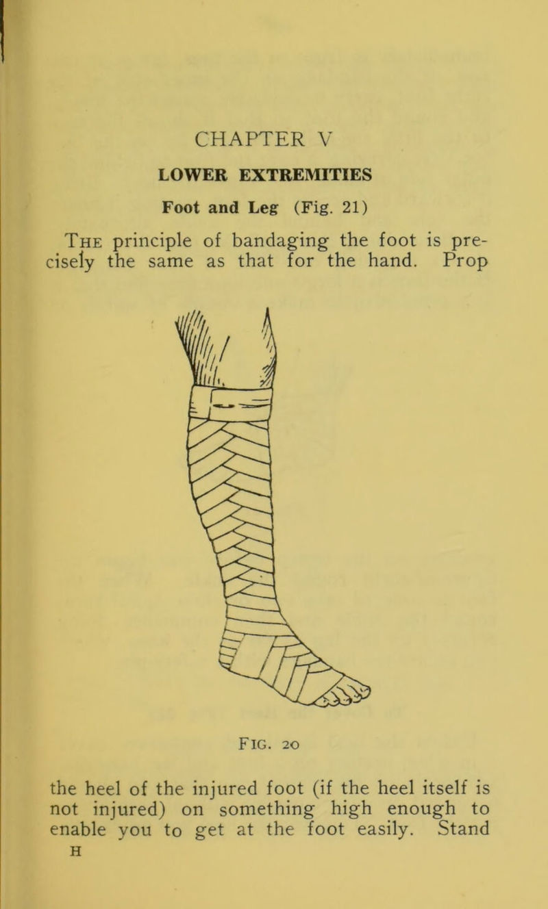 LOWER EXTREMITIES Foot and Leg (Fig. 21) The principle of bandaging the foot is pre- cisely the same as that for the hand. Prop the heel of the injured foot (if the heel itself is not injured) on something high enough to enable you to get at the foot easily. Stand H