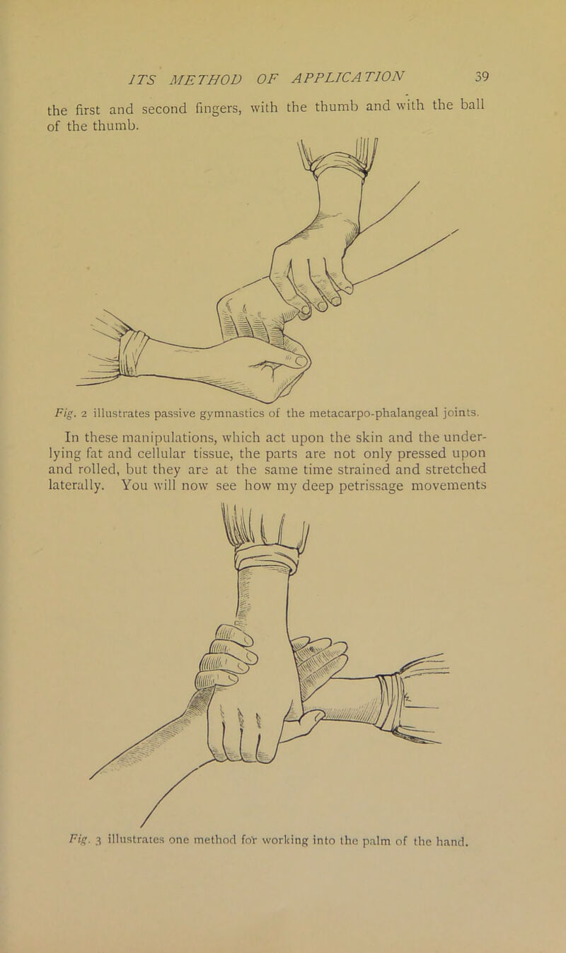 the first and second fingers, with the thumb and with the ball of the thumb. Fig. 2 illustrates passive gymnastics of the metacarpo-phalangeal joints. In these manipulations, which act upon the skin and the under- lying fat and cellular tissue, the parts are not only pressed upon and rolled, but they are at the same time strained and stretched laterally. You will now see how my deep petrissage movements Fig. 3 illustrates one method fo'r working into the palm of the hand.