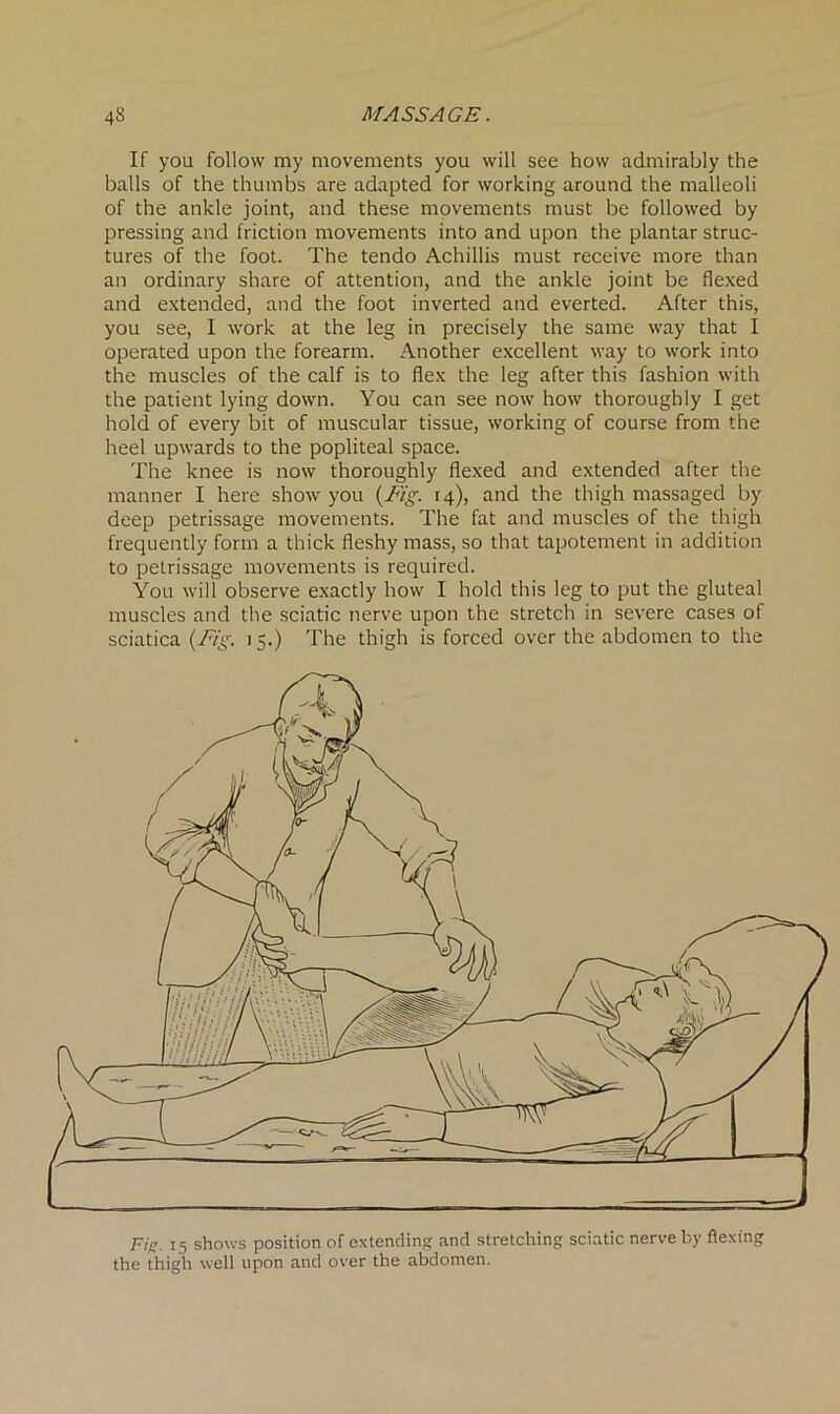 If you follow my movements you will see how admirably the balls of the thumbs are adapted for working around the malleoli of the ankle joint, and these movements must be followed by pressing and friction movements into and upon the plantar struc- tures of the foot. The tendo Achillis must receive more than an ordinary share of attention, and the ankle joint be flexed and extended, and the foot inverted and everted. After this, you see, I work at the leg in precisely the same way that I operated upon the forearm. Another excellent way to work into the muscles of the calf is to flex the leg after this fashion with the patient lying down. You can see now how thoroughly I get hold of every bit of muscular tissue, working of course from the heel upwards to the popliteal space. The knee is now thoroughly flexed and extended after the manner I here show you {Fig. 14), and the thigh massaged by deep petrissage movements. The fat and muscles of the thigh frequently form a thick fleshy mass, so that tapotement in addition to petrissage movements is required. You will observe exactly how I hold this leg to put the gluteal muscles and the sciatic nerve upon the stretch in severe cases of sciatica (Fig. 1 5.) The thigh is forced over the abdomen to the Fig. 15 shows position of extending and stretching sciatic nerve by flexing the thigh well upon and over the abdomen.