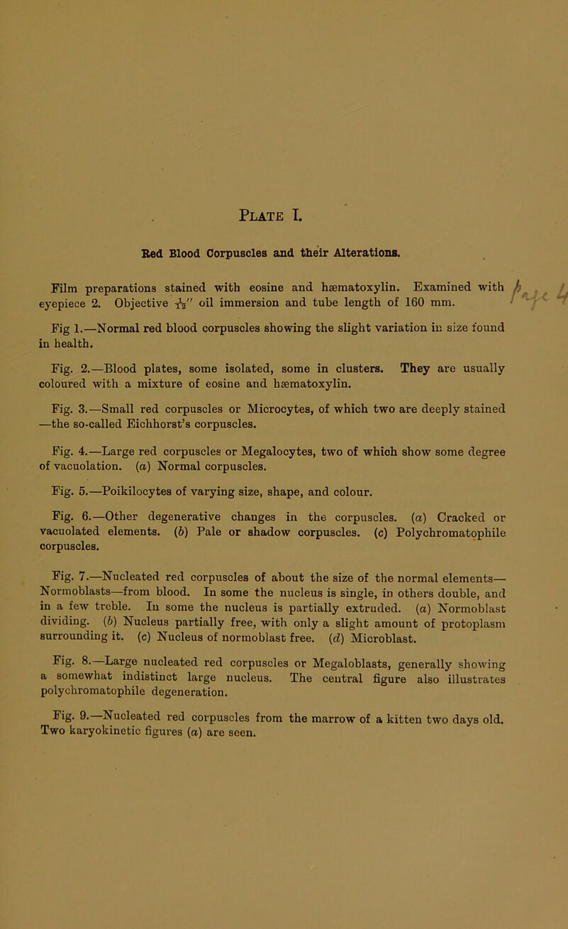 Bed Blood Corpuscles and their Alterations. Film preparations stained with eosine and haematoxylin. Examined with eyepiece 2. Objective J? oil immersion and tube length of 160 mm. Fig 1.—Normal red blood corpuscles showing the slight variation in size found in health. Fig. 2.—Blood plates, some isolated, some in clusters. They are usually coloured with a mixture of eosine and haematoxylin. Fig. 3.—Small red corpuscles or Microcytes, of which two are deeply stained —the so-called Eichhorst’s corpuscles. Fig. 4.—Large red corpuscles or Megalocytes, two of which show some degree of vacuolation. (a) Normal corpuscles. Fig. 5.—Poikilocytes of varying size, shape, and colour. Fig. 6.—Other degenerative changes in the corpuscles, (a) Cracked or vacuolated elements. (6) Pale or shadow corpuscles, (c) Polychromatophile corpuscles. Fig. 7.—Nucleated red corpuscles of about the size of the normal elements— Normoblasts—from blood. In some the nucleus is single, in others double, and in a few treble. In some the nucleus is partially extruded, (a) Normoblast dividing. (6) Nucleus partially free, with only a slight amount of protoplasm surrounding it. (c) Nucleus of normoblast free, (d) Microblast. Fig. 8. Large nucleated red corpuscles or Megaloblasts, generally showing a somewhat indistinct large nucleus. The central figure also illustrates polychromatophile degeneration. Fig. 9.—Nucleated red corpuscles from the marrow of a kitten two days old. Two karyokinetic figures (a) are seen.