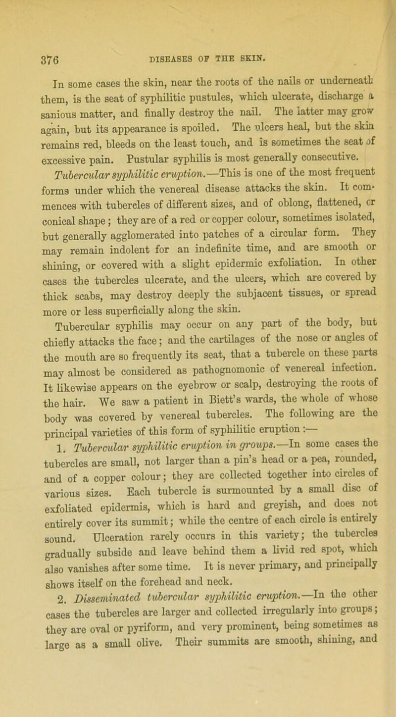 In some cases the skin, near tlie roots of the nails or underneath tliem, is the seat of syphilitic pustules, wliicli ulcerate, discharge a sanious matter, and finally destroy the nail. The iatter may grow again, but its appearance is spoiled. The olcers heal, but the skin remains red, bleeds on the least touch, and is sometimes the seat of excessive pain. Pustular syphilis is most generally consecutive. Tubercular syphilitic éruption.—Tliis is one of the most frequent forma under which the venereal disease attacks the skin. It com* mences witli tubereles of different sizes, and of oblong, flattened, or conieal shape ; they axe of a red or copper colour, sometimes isolated, but generally agglomerated into patches of a circular form. They may remain indolent for an indefinite tirne, and are smooth or RbîTiing, or covered with a slight epidermic exfoliation. In other cases the tubereles ulcerate, and the ulcers, which are covered by tkick scabs, may destroy deeply the subjacent tissues, or spread more or less superficially along the skin. Tubercular syphilis may occur on any part of the body, but chiefly attacks the face ; and the cartilages of the nose or angles of the mouth are so frequently its seat, that a tubercle on these parts may almost be considered as patkognomonic of venereal infection. It likewise appears on the eyebrow or scalp, destroying the roots of the hair. We saw a patient in Biett’s wards, the whole of whose body was covered by venereal tubereles. The following are the principal varieties of this form of syphilitic éruption 1. Tubercular syphilitic éruption in groupa.—In some cases the tubereles are small, not larger than a pin’s head or a pea, rounded, and of a copper colour ; they are collected together into circles of various sizes. Bach tubercle is surmounted by a small dise of exfoliated epidermis, which is hard and greyish, and does not entirely cover its summit ; while the centre of each circle is entirely sound. Ulcération rarely occurs in this variety; the tubereles gradually subside and leave behind tliem a livid red spot, which also vanishes after some time. It is never primary, and principally shows itself on the forehead and neck. 2. Disseminatcd tubercular syphilitic éruption.—In the other cases the tubereles are larger and collected irregularly into groups ; they are oval or pyriform, aud very prominent, being sometimes as large as a small olive. Tkeir summits are smooth, shilling, and