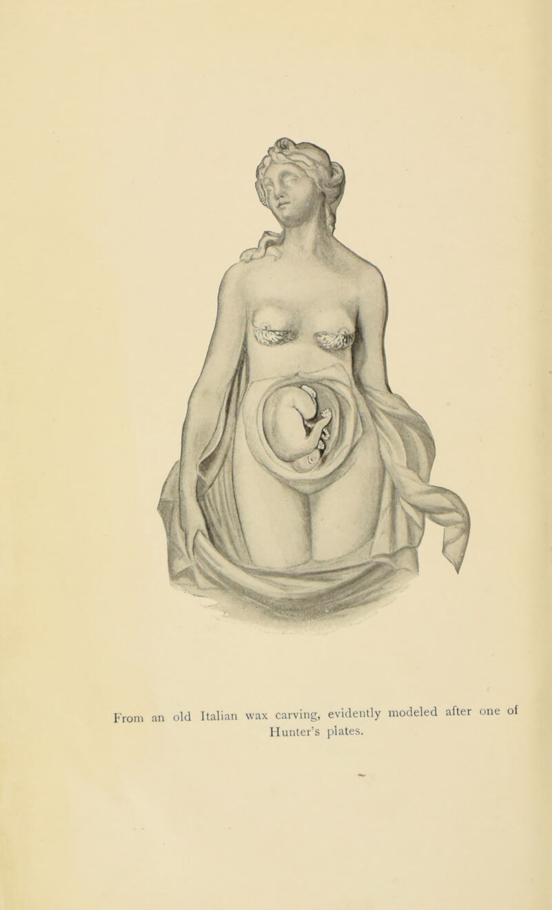 From an old Italian wax carving, evidently modeled after one of Hunter’s plates.