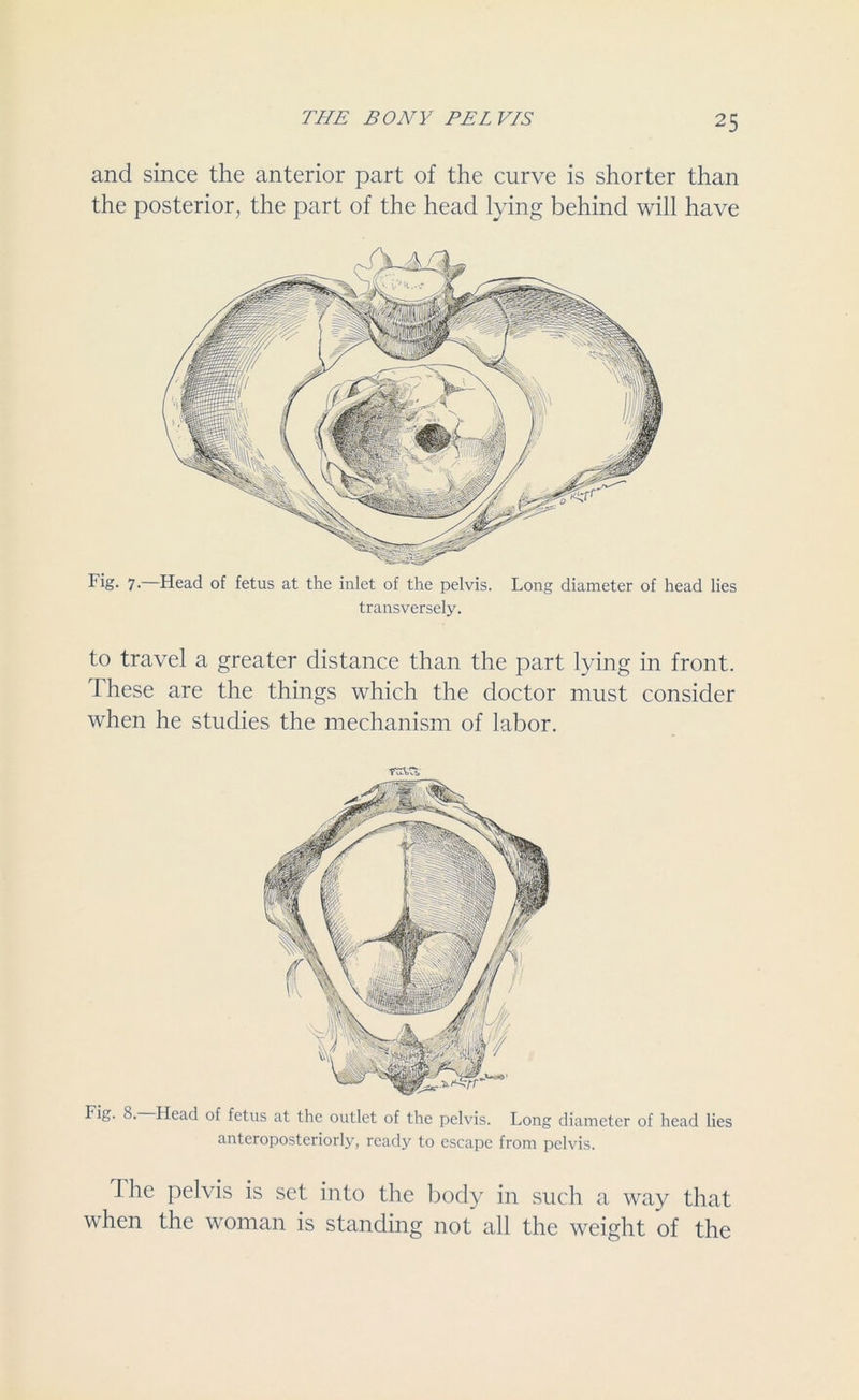 and since the anterior part of the curve is shorter than the posterior, the part of the head lying behind will have Fig- 7-—Head of fetus at the inlet of the pelvis. Long diameter of head lies transversely. to travel a greater distance than the part lying in front, these are the things which the doctor must consider when he studies the mechanism of labor. raa Fig. 8. Head of fetus at the outlet of the pelvis. Long diameter of head lies anteroposteriorly, ready to escape from pelvis. The pelvis is set into the body in such a way that when the woman is standing not all the weight of the
