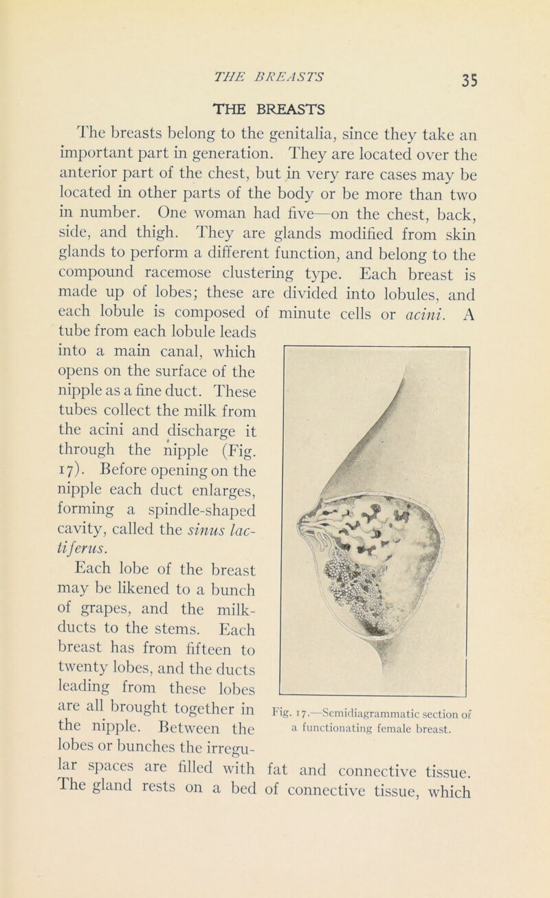 THE BREASTS THE BREASTS The breasts belong to the genitalia, since they take an important part in generation. They are located over the anterior part of the chest, but in very rare cases may be located in other parts of the body or be more than two in number. One woman had five—on the chest, back, side, and thigh. They are glands modified from skin glands to perform a different function, and belong to the compound racemose clustering type. Each breast is made up of lobes; these are divided into lobules, and each lobule is composed of minute cells or acini. A tube from each lobule leads into a main canal, which opens on the surface of the nipple as a fine duct. These tubes collect the milk from the acini and discharge it through the nipple (Fig. 17). Before opening on the nipple each duct enlarges, forming a spindle-shaped cavity, called the sinus lac- tiferns. Each lobe of the breast may be likened to a bunch of grapes, and the milk- ducts to the stems. Each breast has from fifteen to twenty lobes, and the ducts leading from these lobes are all brought together in the nipple. Between the lobes or bunches the irregu- lar spaces are filled with The gland rests on a bed Fig- r7-—Semidiagrammatic section of a functionating female breast. fat and connective tissue, of connective tissue, which