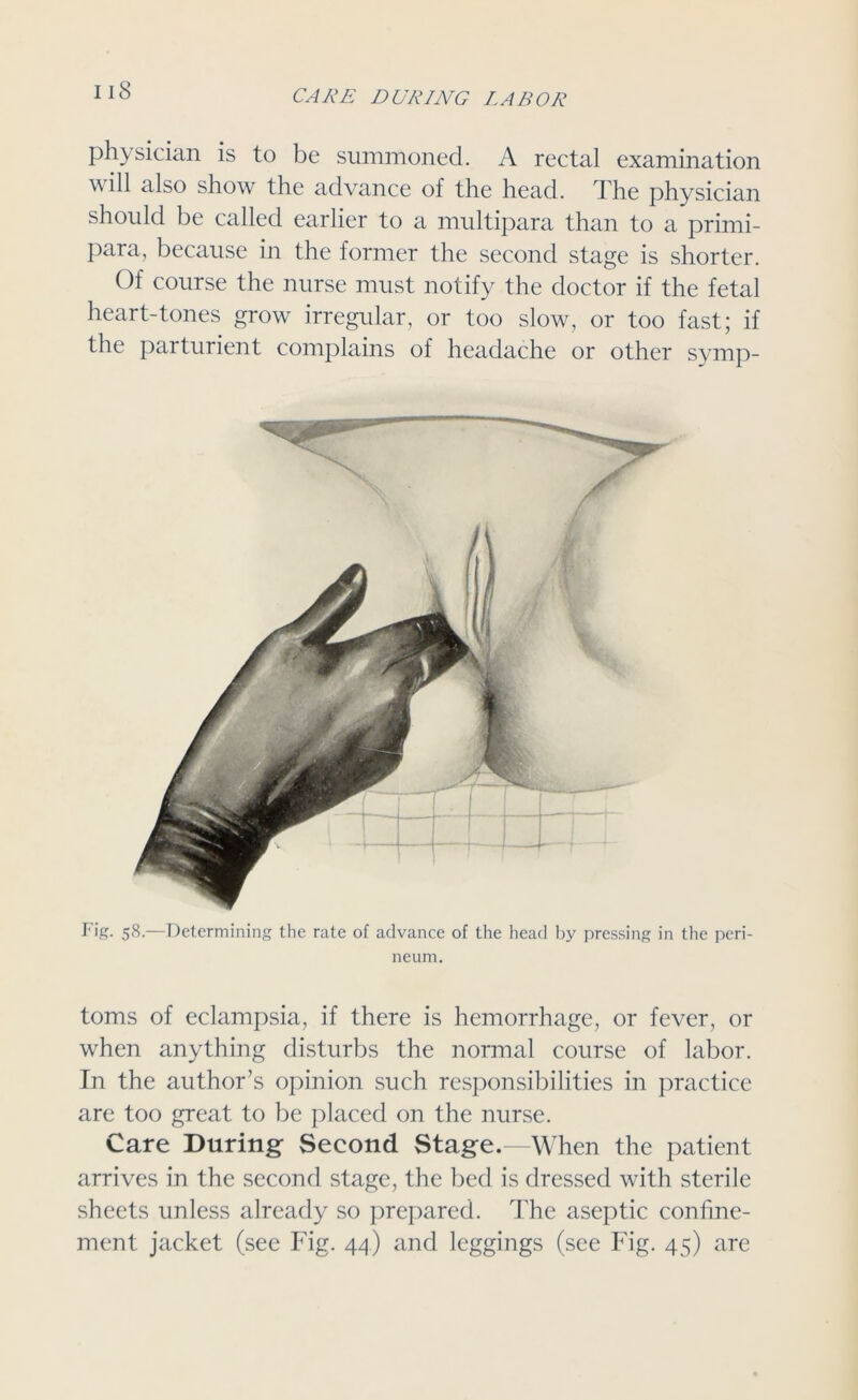 physician is to be summoned. A rectal examination wiH <dso show the advance of the head. The physician should be called earlier to a multipara than to a primi- para, because in the former the second stage is shorter. Of course the nurse must notify the doctor if the fetal heart-tones grow irregular, or too slow, or too fast; if the parturient complains of headache or other symp- Fig. 58.—Determining the rate of advance of the head by pressing in the peri- neum. toms of eclampsia, if there is hemorrhage, or fever, or when anything disturbs the normal course of labor. In the author’s opinion such responsibilities in practice are too great to be placed on the nurse. Care During Second Stage.—When the patient arrives in the second stage, the bed is dressed with sterile sheets unless already so prepared. The aseptic confine- ment jacket (see Fig. 44) and leggings (see Fig. 45) are
