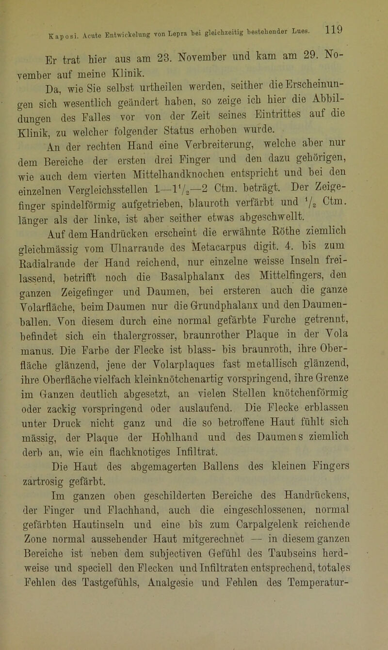 lr trat hier ans am 23. November und kam am 29. No- vember auf meine Klinik. Da, wie Sie selbst urtheilen werden, seither die Erscheinun- gen sich wesentlich geändert haben, so zeige ich hier die Abbil- dungen des Falles vor von der Zeit seines Eintrittes auf die Klinik, zu welcher folgender Status erhoben wurde. An der rechten Hand eine Verbreiterung, welche aber nur dem Bereiche der ersten drei Finger und den dazu gehörigen, wie auch dem vierten Mittelhandknochen entspricht und bei den einzelnen Vergleichsstellen 1—17,-2 Ctm. beträgt. Der Zeige- finger spindelförmig aufgetrieben, blauroth verfärbt und 7z Ctm. länger als der linke, ist aber seither etwas abgeschwellt. Auf dem Handrücken erscheint die erwähnte Itöthe ziemlich gleichmässig vom Ulnarrande des Metacarpus digit. 4. bis zum Kadialraude der Hand reichend, nur einzelne weisse Inseln frei- lassend, betrifft noch die Basalphalanx des Mittelfingers, den ganzen Zeigefinger und Daumen, bei ersteren auch die ganze Volarfläche, beim Daumen nur die Grundphalanx und den Daumen- hallen. Von diesem durch eine normal gefärbte Furche getrennt, befindet sich ein thalergrosser, hraunrother Plaque in der Vola maniis. Die Farbe der Flecke ist blass- bis braunroth, ihre Ober- fläche glänzend, jene der Volarplaques fast metallisch glänzend, ihre Oberfläche vielfach kleinknötchenartig vorspringend, ihre Grenze im Ganzen deutlich ahgesetzt, an vielen Stellen knötchenförmig oder zackig vorspringend oder auslaufend. Die Flecke erblassen unter Druck nicht ganz und die so betroffene Haut fühlt sich mässig, der Plaque der Hohlhand und des Daumens ziemlich derb an, wie ein flachknotiges Infiltrat. Die Haut des abgemagerten Ballens des kleinen Fingers zartrosig gefärbt. Im ganzen oben geschilderten Bereiche des Handrückens, der Finger und Flachhand, auch die eingeschlossenen, normal gefärbten Hautiuseln und eine bis zum Carpalgelenk reichende Zone normal aussehender Haut mitgerechnet — in diesem ganzen Bereiche ist neben dem subjectiven Gefühl des Taubseins herd- weise und speciell den Flecken und Infiltraten entsprechend, totales Fehlen des Tastgefühls, Analgesie und Fehlen des Temperatur-