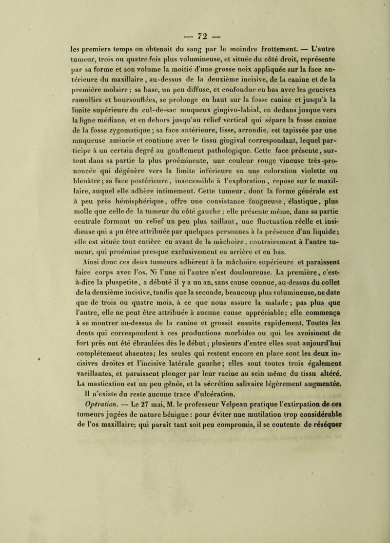 les premiers temps on obtenait du sang par le moindre frottement. — L’autre tumeur, trois ou quatre fois plus volumineuse, et située du côté droit, représente par sa forme et son volume la moitié d’une grosse noix appliquée sur la face an- térieure du maxillaire , au-dessus de la deuxième incisive, de la canine et de la première molaire ; sa base, un peu diffuse, et confondue en bas avec les gencives ramollies et boursouHées, se prolonge en haut sur la fosse canine et jusqu’à la limite supérieure dn cul-de-sac muqueux gingivo-labial, en dedans jusque vers la ligne médiane, et en dehors jusqu'au relief vertical qui sépare la fosse canine de la fosse zygomatique ; sa face antérieure, lisse, arrondie, est tapissée par une muqueuse amincie et continue avec le tissu gingival correspondant, lequel par- ticipe à un certain degré au gonllement pathologique. Cette face présente, sur- tout dans sa partie la plus proéminente, une couleur rouge vineuse très-pro- noncée qui dégénère vers la limite inférieure en une coloration violette ou bleuâtre; sa face postérieure, inaccessible à l’exploration, repose sur le maxil- laire, auquel elle adhère intimement. Celte tumeur, dont la forme générale est à peu près hémisphérique, offre une consistance fongueuse, élastique, plus molle que celle de la tumeur du côté gauche ; elle présente même, dans sa partie centrale formant un relief un peu plus saillant, une fluctuation réelle et insi- dieuse qui a pu être attribuée par quelques personnes à la présence d’un liquide ; elle est située tout entière en avant de la mâchoire, contrairement à l’autre tu- meur, qui proémine presque exclusivement en arrière et en bas. Ainsi donc ces deux tumeurs adhèrent à la mâchoire supérieure et paraissent faire corps avec l’os. Ni l’une ni l’autre n’est douloureuse. La première, c’est- à-dire la pluspelite, a débuté il y a un an, sans cause connue, au-dessus du collet delà deuxième incisive, tandis que la seconde, beaucoup plus volumineuse, ne date que de trois ou quatre mois, à ce que nous assure la malade; pas plus que l’autre, elle ne peut être attribuée à aucune cause appréciable; elle commença à se montrer au-dessus de la caniue et grossit ensuite rapidement. Toutes les dents qui correspondent à ces productions morbides ou qui les avoisinent de fort près ont été ébranlées dès le début; plusieurs d’entre elles sont aujourd’hui complètement absentes; les seules qui restent encore en place sont les deux in- cisives droites et l’incisive latérale gauche; elles sont toutes trois également vacillantes, et paraissent plonger par leur racine au sein même du tissu altéré. La mastication est un peu gênée, et la sécrétion salivaire légèrement augmentée. 11 n’existe du reste aucune trace d’ulcération. Opération. — Le 27 mai, M. le professeur Velpeau pratique l’extirpation de ces tumeurs jugées de nature bénigne : pour éviter une mutilation trop considérable de l’os maxillaire; qui paraît tant soit peu compromis, il se contente de réséquer