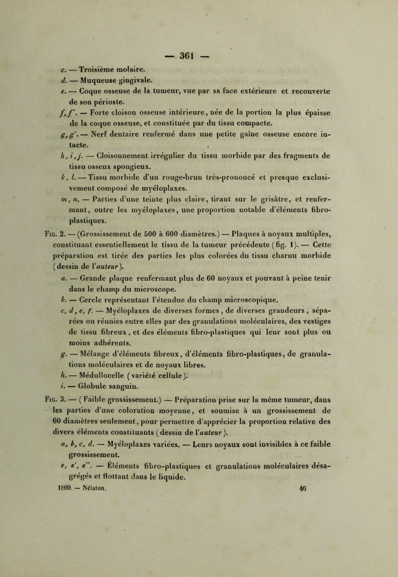 c. — Troisième molaire. d. — Muqueuse gingivale. e. — Coque osseuse de la tumeur, vue par sa face extérieure et recouverte de son périoste. f. f‘. — Forte cloison osseuse intérieure, née de la portion la plus épaisse de la coque osseuse, et constituée par du tissu compacte. g. g‘.— Nerf dentaire renfermé dans une petite gaine osseuse encore in- tacte. /zj i,j. — Cloisonnement irrégulier du tissu morbide par des fragments de tissu osseux spongieux. k, l. — Tissu morbide d’un rouge-brun très-prononcé et presque exclusi- vement composé de myéloplaxes. nij n. — Parties d’une teinte |)lus claire, tirant sur le grisâtre, et renfer- mant, outre les myéloplaxes, une proportion notable d’éléments fibro- plastiques. Fig. 2. — (Grossissement de 500 à 600 diamètres.) — Plaques à noyaux multiples, constituant essentiellement le tissu de la tumeur précédente (fig. 1). — Cette préparation est tirée des parties les plus colorées du tissu charnu morbide (dessin de Vauteur). a. — Grande plaque renfermant plus de 60 noyaux et pouvant à peine tenir dans le champ du microscope. h. — Cercle représentant l’étendue du champ microscopique. Cj d,e, f. — Myéloplaxes de diverses formes , de diverses grandeurs , sépa- rées ou réunies entre elles par des granulations moléculaires, des vestiges de tissu fibreux, et des éléments fibro-plastiques qui leur sont plus ou moins adhérents. g. — Mélange d’éléments fibreux, d’éléments fibro-plastiques, de granula- tions moléculaires et de noyaux libres. h. — Médullocelle (variété cellule). i. — Globule sanguin. Fig, 3. — ( Faible grossissement.) — Préparation prise sur la même tumeur, dans les parties d’une coloration moyenne, et soumise à un grossissement de 60 diamètres seulement, pour permettre d’apprécier la proportion relative des divers éléments constituants (dessin de Vauteur). a, b, c, d. — Myéloplaxes variées. — Leurs noyaux sont invisibles à ce faible grossissement. e, e’, e. — Eléments fibro-plastiques et granulations moléculaires désa- grégés et flottant dans le liquide. 1860. - Nélaton. 46