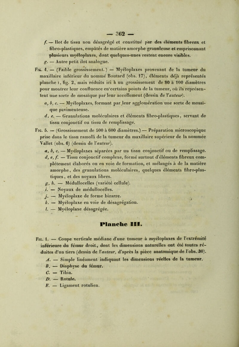 f. — Ilot de tissu nou désagrégé et constitué par des éléments fibreux et fibro-plastiques, empâtés de matière amorphe granuleuse et emprisonnant plusieurs myéloplaxes, dont quelques-unes restent encore visibles. e. — Autre petit ilôt analogue. Fie. 4, — (Faible grossissement. ) — Myéloplaxes provenant de la tumeur du maxillaire inférieur du nommé Boutard (obs. 17), éléments déjà représentés planche i, tig. 2, mais réduits ici à un grossissement de 80 à 100 diamètres pour montrer leur confluence en'certains points de la tumeur, où ils représen- tent une sorte de mosaïque par leur accollement (dessin de Vauteur). a, b, c. — Myéloplaxes, formant par^leur agglomération une sorte de mosaï- que pavimenteuse. d, e. — Granulations moléculaires et éléments fibro-plastiques, servant de tissu conjonctif ou tissu de remplissage. Fig. 5. — (Grossissement de 500 à 600 diamètres.) — Préparation microscopique prise dans le tissu ramolli de la tumeur du maxillaire supérieur de la nommée Vallet (obs. 6) (dessin de \auleut). a, b, c. — Myéloplaxes séparées par un tissu conjonctif ou de remplissage. dj e, f. — Tissu conjonctif complexe, formé surtout d’éléments fibreux com- plètement élaborés ou en voie de formation, et mélangés à de la matière amorphe, des granulations moléculaires, quelques éléments fibro-plas- tiques , et des noyaux libres. g, h. — Médullocelles (variété cellule). i. — Noyaux de médullocelles. j. — Myéloplaxe de forme bizarre. k. — Myéloplaxe en voie de désagrégation. l. — Myéloplaxe désagrégée. Plancbe III. Fig. 1. — Coupe verticale médiane d’une tumeur à myéloplaxes de l’extrémité inférieure du fémur droit, dont les dimensions naturelles ont été toutes ré- duites d’un tiers (dessin de Vauteur^ d’après la pièce anatomique de l’obs. 30). A. — Simple linéament indiquant les dimensions réelles de la tumeur. B. — Diaphyse du fémur. C. — Tibia. D. — Rotule. E. — Ligament rotulien.