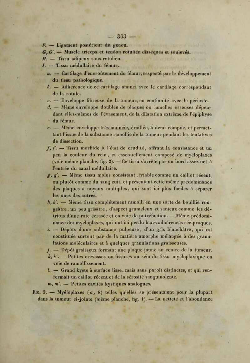 — 3G3 F. — Ligament postérieur du genou. G. G\ — Muscle triceps et tendon rotulien disséqués et soulevés. H. — Tissu adipeux sous-rotulieu. I. — Tissu médullaire du fémur. a, — Cartilage d’encroûtement du fémur, respecté par le développement du tissu pathologique. b. — Adhérence de ce cartilage aminci avec le cartilage correspondant de la rotule. c. — Enveloppe fibreuse de la tumeur, en continuité avec le périoste. d. — Même enveloppe doublée de plaques ou lamelles osseuses dépen- dant elles-mêmes de l’évasement, de la dilatation extrême de l’épiphyse ' du fémur. e. — Même enveloppe très-amincie, éraillée, à demi rompue, et permet- tant l’issue de la substance ramollie de la tumeur pendant les tentatives de dissection. f, f, — Tissu morbide à l’état de crudité, offrant la consistance et un peu la couleur du rein, et essentiellement composé de myéloplaxes (voir même planche, fig. 2). — Ce tissu s’arrête par un bord assez net à l’entrée du canal médullaire. g, g\ — Même tissu moins consistant, friable comme un caillot récent, ou plutôt comme du sang cuit, et présentant cette même prédominance des plaques à noyaux multiples, qui sont ici plus faciles à séparer les unes des autres. h, h\ — Même tissu complètement ramolli en une sorte de bouillie rou- geâtre, un peu grisâtre, d’aspect grumeleux et sanieux comme les dé- tritus d’une rate écrasée et eu voie de putréfaction. — Même prédomi- nance des myéloplaxes, qui ont ici perdu leurs adhérences réciproques. I. — Dépôts d’une substance pulpeuse, d’un gris blanchâtre, qui est constituée surtout par de la matière amorphe mélangée à des granu- lations moléculaires et à quelques granulations graisseuses. J. — Dépôt graisseux formant une plaque jaune au centre de la tumeur. k, k\ — Petites crevasses ou fissures au sein du tissu myéloplaxique en voie de ramollissement. l, — Grand kyste à surface lisse, mais sans parois distinctes, et qui ren- fermait un caillot récent et de la sérosité sanguinolente. m, tn. — Petites cavités kystiques analogues. Fig. 2. — Myéloplaxes (a, b) telles qu’elles se présentaient pour la plupart dans la tumeur ci-jointe (même planche, fig. 1). — La netteté et l’abondance