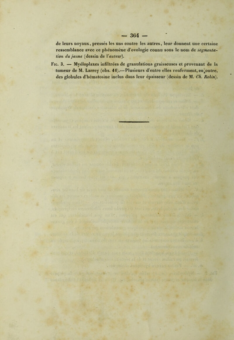 de leurs noyaux, pressés les uns contre les autres, leur donnent une certaine ressemblance avec ce phénomène d’ovologie connu sous le nom de segmenta- tion du jaune (dessin de Vauteur). Fig. 3. — Myéloplaxes infiltrées de granulations graisseuses et provenant de la tumeur de M. Larrey (obs. 44).— Plusieurs d’entre elles renferment, enjOutre, des globules d’hématosine inclus dans leur épaisseur (dessin de M. Ch. Robin).