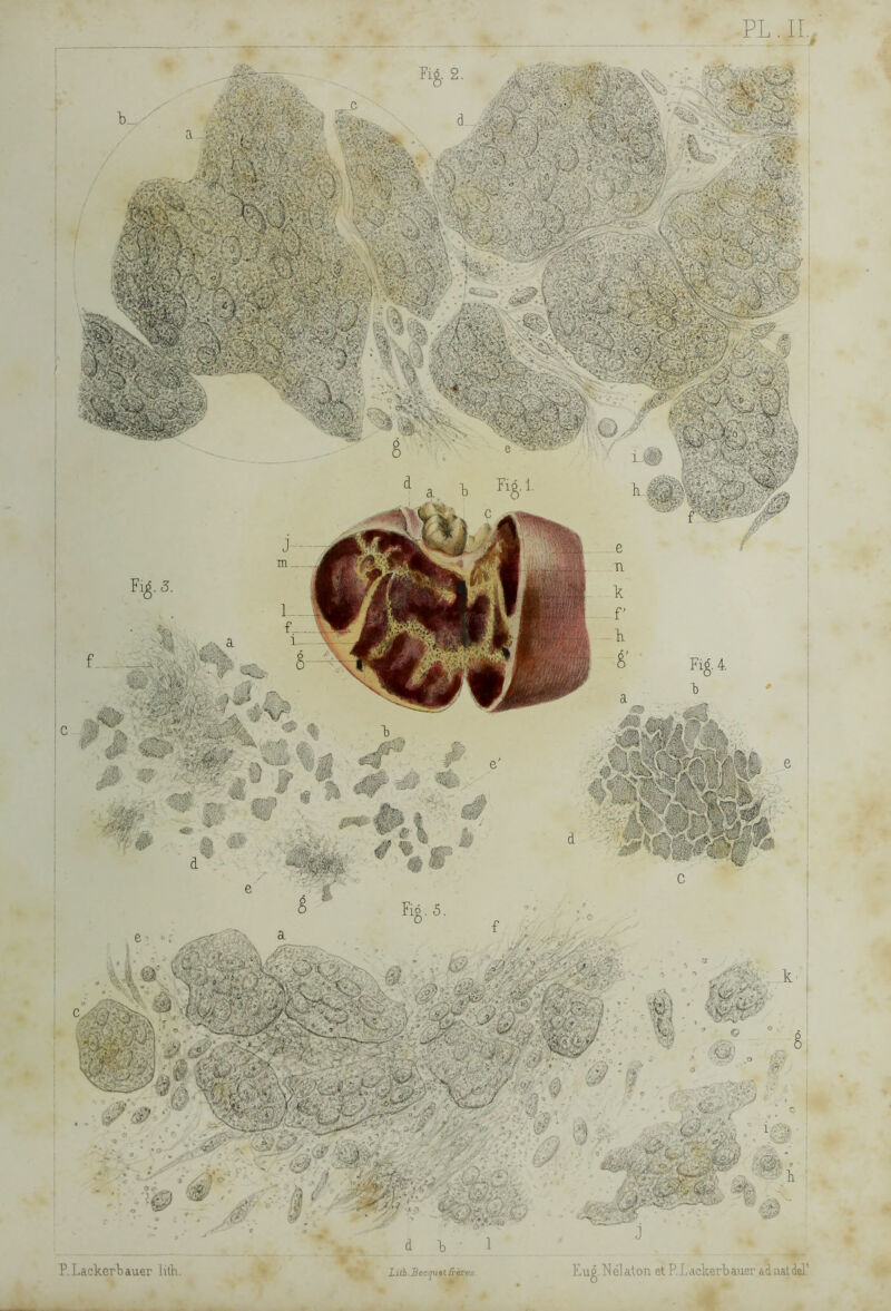 P. Lackcrtauer lith, uih Bcofitin-èrcs l’.ug.Nélalon etP.Lackerbauevidiiâldel!