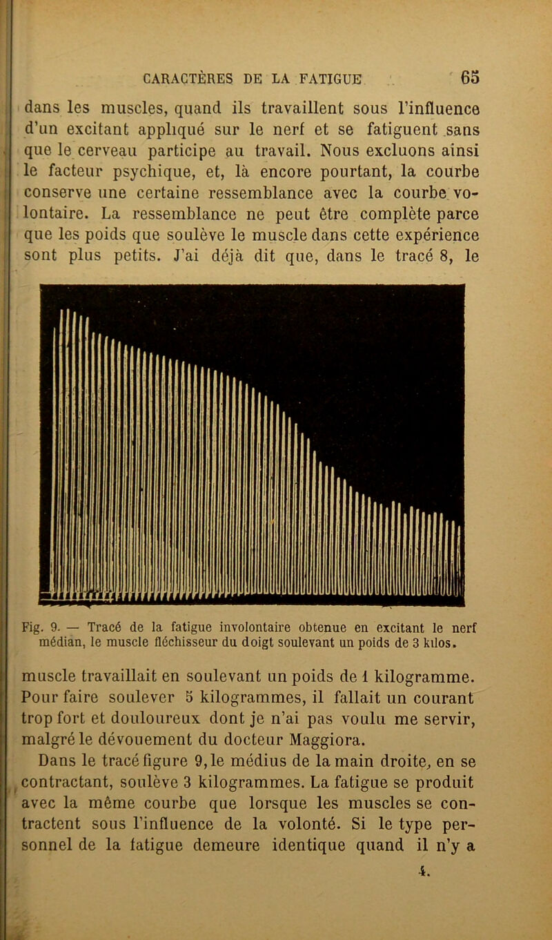 dans les muscles, quand ils travaillent sous l’influence d’un excitant applique sur le neri et se fatiguent sans que le cerveau participe au travail. Nous excluons aitisi le facteur psychique, et, là encore pourtant, la courbe conserve une certaine ressemblance avec la courbe vo- lontaire. La ressemblance ne peut ètre complète parce que les poids que soulève le muscle dans cette expérience sont plus petits. J’ai déjà dit que, dans le tracé 8, le Fig. 9. — Tracé de la fatigue involontaire obtenue en excitant le nerf raédian, le muscle fléchisseur du doigt soulevant un poids de 3 kilos. muscle travaillait en soulevant un poids de 1 kilogramme. Pour taire soulever 5 kilogrammes, il fallait un courant tropfort et douloureux dont je n’ai pas voulu me servir, malgréle dévouement du docteur Maggiora. Dans le tracé figure 9, le médius de lamain droite, en se contractant, soulève 3 kilogrammes. La fatigue se produit avec la mème courbe que lorsque les muscles se con- tractent sous l’influence de la volonté. Si le type per- sonnel de la fatigue demeure identique quand il n’y a 4.