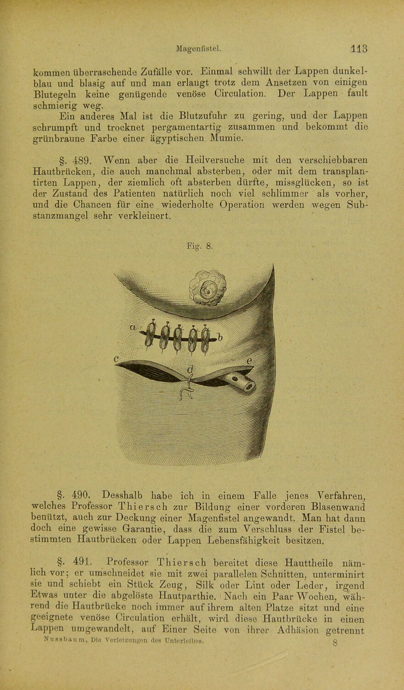 kommen überraschende Zufalle vor. Einmal schwillt der Lappen dunkel- blau und blasig auf und man erlangt trotz dem Ansetzen von einigen Blutegeln keine genügende venöse Circulation. Der Lappen fault schmierig weg. Ein anderes Mal ist die Blutzufuhr zu gering, und der Lappen schrumpft und trocknet pergamentartig zusammen und bekommt die grünbraune Farbe einer ägyptischen Mumie. §. 489. Wenn aber die Heilversuche mit den verschiebbaren Hautbrücken, die auch manchmal absterben, oder mit dem transplan- tirten Lappen, der ziemlich oft absterben dürfte, missglücken, so ist der Zustand des Patienten natürlich noch viel schlimmer als vorher, und die Chancen für eine wiederholte Operation werden wegen Sub- stanzmangel sehr verkleinert. Fig. 8. §. 490. Desshalb habe ich in einem Palle jenes Verfahren, welches Professor Thiersch zur Bildung einer vorderen Blasenwand benützt, auch zur Deckung einer Magenfistel angewandt. Man hat dann doch eine gewisse Garantie, dass die zum Verschluss der Fistel be- stimmten Hautbrücken oder Lappen Lebensfähigkeit besitzen. §. 491. Professor Thiersch bereitet diese Hauttheile näm- lich vor; er umschneidet sie mit zwei parallelen Schnitten, unterminirt sie und schiebt ein Stück Zeug, Silk oder Lint oder Leder, irgend Etwas unter die abgelöste Hautparthie. ' Nach ein Paar Wochen, wäh- rend die Hautbrücke noch immer auf ihrem alten Platze sitzt imd eine geeignete venöse Circulation erhält, wird diese Hautbrücke in einen Lappen umgewandelt, auf Einer Seite von ihrer Adhäsion getrennt Niigsbanm, Dlo Vorletzmigeu des Unterleibes. <5