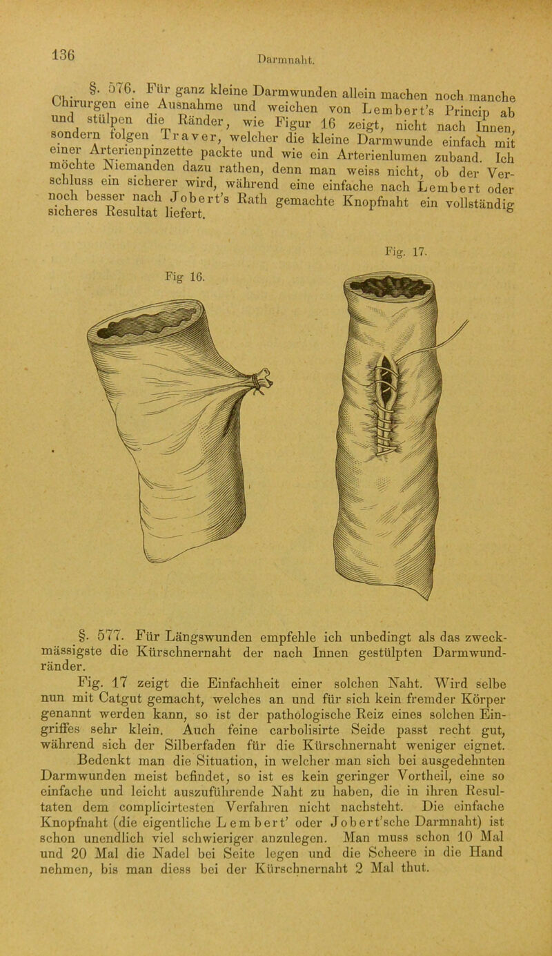 Ph,V ^ Darm wunden allein machen noch manche thirurgen eine Ausnahme und weichen von Lembert’s Princip ab und Stulpen die Ränder, wie Figur 16 zeigt, nicht nach iLen, sondern folgen Traver, welcher die kleine Darmwunde einfach mit einei Ai^erienpmzette packte und wie ein Arterienlumen zuband. Ich mochte Niemanden dazu rathen, denn man weiss nicht, ob der Ver- schluss ein sicherer wird, während eine einfache nach Lembert oder Ser^^'Resultat^h^ä gemachte Knopfnaht ein vollständig Fig. 17. §. 577. Für Längswunden empfehle ich unbedingt als das zweck- massigste die Kürschnernaht der nach Innen gestülpten Darmwund- ränder. Fig. 17 zeigt die Einfachheit einer solchen Naht. Wird selbe nun mit Catgut gemacht, welches an und für sich kein fremder Körper genannt werden kann, so ist der pathologische Reiz eines solchen Ein- griffes sehr klein. Auch feine carbolisirte Seide passt recht gut, während sich der Silberfaden für die Kürschnernaht weniger eignet. Bedenkt man die Situation, in welcher man sich bei ausgedehnten Darmwunden meist befindet, so ist es kein geringer Vortheil, eine so einfache und leicht auszuführende Naht zu haben, die in ihren Resul- taten dem complicirtcsten Verfahren nicht nachsteht. Die einfache Knopfnaht (die eigentliche Lembert’ oder Jobert’sche Darmnaht) ist schon unendlich viel schwieriger anzulegen. Man muss schon 10 Mal und 20 Mal die Nadel bei Seite legen und die Scheere in die Iland nehmen, bis man diess bei der Kürschnernaht 2 Mal thut.