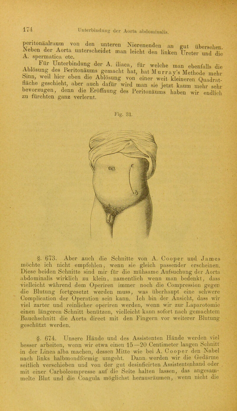 peritonäalmum von den unteren Nierenenden nn gut übersehen Neben der Aorta unterscheidet man leicht den linken Ureter und die A. spermatica etc. Für Untm-bindung der A. iliaca, für welche man ebenfalls die Ablösung des P^ritonäums gemacht hat, hat M urray’s Methode mehr binn, weil hier eben die Ablösung von einer weit kleineren Quadrat- tiache geschieht, aber auch dafür wird man sie jetzt kaum mehr sehr bevorzugen, denn die Eröffnung des Peritonäums haben wir endlich zu fürchten ganz verlernt. Fig. 31. §. 673. Aber auch die Schnitte von A. Cooper und James möchte ich nicht empfehlen, wenn sie gleich passender erscheinen. Diese beiden Schnitte sind mir für die mühsame Aufsuchung der Aorta abdominalis wirklich zu klein, namentlich wenn man bedenkt, dass vielleicht während dem Operiren immer noch die Compression gegen die Blutung fortgesetzt werden muss, was überhaupt eine schwere Complication der Operation sein kann. Ich bin der Ansicht, dass wir viel zarter und reinlicher operiren werden, wenn wir zur Laparotomie einen längeren Schnitt benützen, vielleicht kann sofort nach gemachtem Bauchschnitt die Aorta direct mit den Fingern vor weiterer Blutung geschützt werden. §. 674. Unsere Hände und des Assistenten Hände werden viel besser arbeiten, wenn wir etwa einen 15—20 Centimeter langen Schnitt in der Linea alba machen, dessen Mitte wie bei A. Cooper den Nabel nach links halbmondförmig umgeht. Dann werden wir die Gedärme seitlich verschieben und von der gut desinficirten Assistentenhand oder mit einer Carbolcompresse auf die Seite halten lassen, das angesam- melte Blut und die Coagula möglichst herausräumen, wenn nicht die