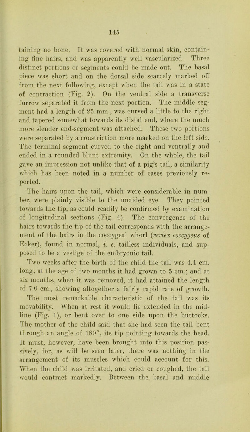 145 taming no bone. It was covered with normal skin, contain- ing fine hairs, and was apparently well vascularized. Three distinct portions or segments could be made out. The basal piece was short and on the dorsal side scarcely marked ofii from the next following, except when the tail was in a state of contraction (Fig. 2). On the ventral side a transverse furrow separated it from the next portion. The middle seg- ment had a length of 25 mm., was curved a little to the right and tapered somewhat towards its distal end, where the much more slender end-segment was attached. These two portions were separated bv a constriction more marked on the left side. The terminal segment curved to the right and ventrally and ended in a rounded blunt extremity. On the whole, the tail gave an impression not unlike that of a pig’s tail, a similarity which has been noted in a number of cases previously re- ported. The hairs upon the tail, which were considerable in num- ber, were plainly visible to the unaided eye. They pointed towards the tip, as could readily be confirmed by examination of longitudinal sections (Fig. 4). The convergence of the hairs towards the tip of the tail corresponds with the arrange- ment of the hairs in the coccygeal whorl (vertex coccygeus of Ecker), found in normal, i. e. tailless individuals, and sup- posed to be a vestige of the embryonic tail. Two weeks after the birth of the child the tail was 4.4 cm. long; at the age of two months it had grown to 5 cm.; and at six months, when it was removed, it had attained the length of 7.0 cm., showing altogether a fairly rapid rate of growth. The most remarkable characteristic of the tail was its movability. When at rest it would lie extended in the mid- line (Fig. 1), or bent over to one side upon the buttocks. The mother of the child said that she had seen the tail bent through an angle of 180°, its tip pointing towards the head. It must, however, have been brought into this position pas- sively, for, as will be seen later, there was nothing in the arrangement of its muscles which could account for this. When the child was irritated, and cried or coughed, the tail would contract markedly. Between the basal and middle