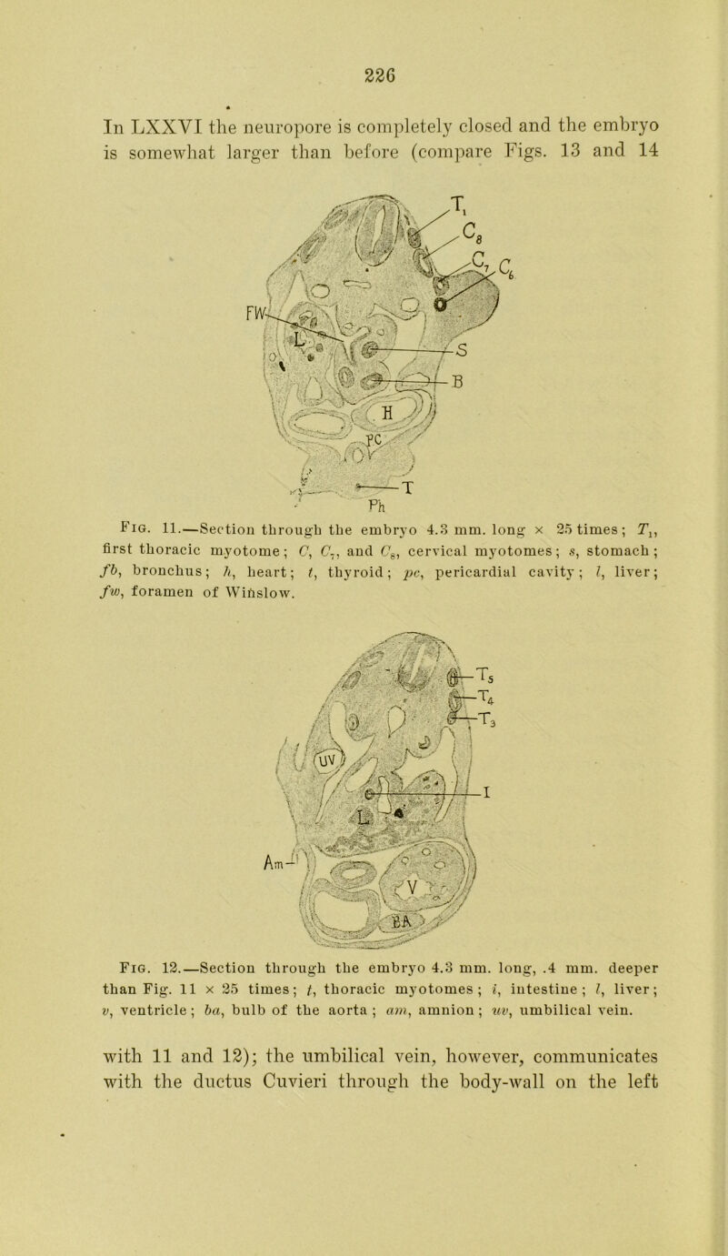 In LXXYI the neuropore is completely closed and the embryo is somewhat larger than before (compare Figs. 13 and 14 Fig. 11.—Section through the embryo 4.3 mm. long x 25 times ; T„ first thoracic myotome; C, C~, ancl C8, cervical myotonies; s, stomach; fb, bronchus; h, heart; t, thyroid; pc, pericardial cavity; l, liver; fw, foramen of Wifislow. Fig. 12.—Section through the embryo 4.3 mm. long, .4 mm. deeper than Fig. 11 x 25 times; t, thoracic myotonies ; i, intestine; 7, liver; ventricle ; ba, bulb of the aorta ; am, amnion ; uv, umbilical vein. with 11 and 12); the umbilical vein, however, communicates with the ductus Cuvieri through the body-wall on the left