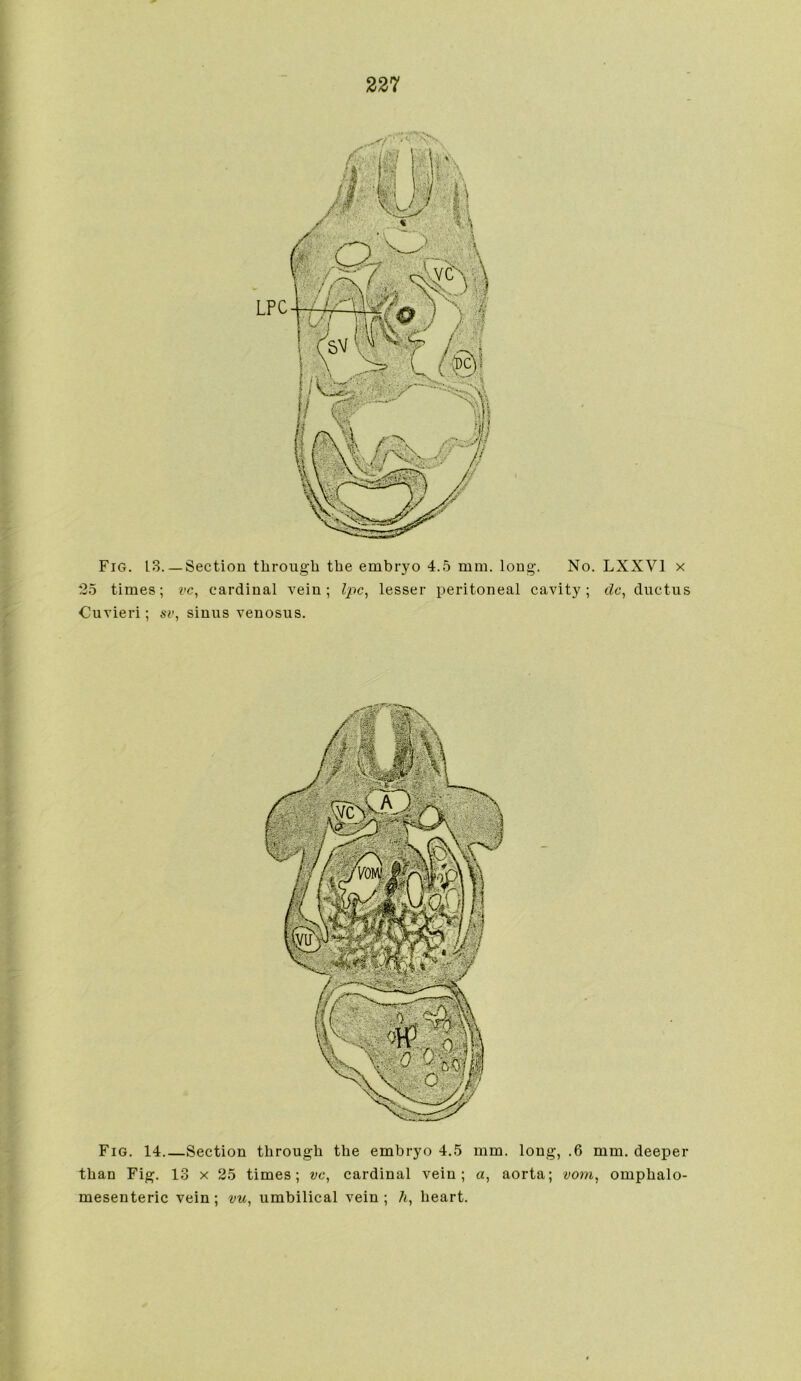 Fig. 13. —Section through the embryo 4.5 mm. long. No. LXXV1 x *35 times; cardinal vein; Ipc, lesser peritoneal cavity; dc, ductus Cuvieri; sv, sinus venosus. ' Fig. 14.—Section through the embryo 4.5 mm. long, .6 mm. deeper than Fig. 13 x 25 times; vc, cardinal vein; a, aorta; vom, omphalo- mesenteric vein; vu, umbilical vein; 7j, heart.