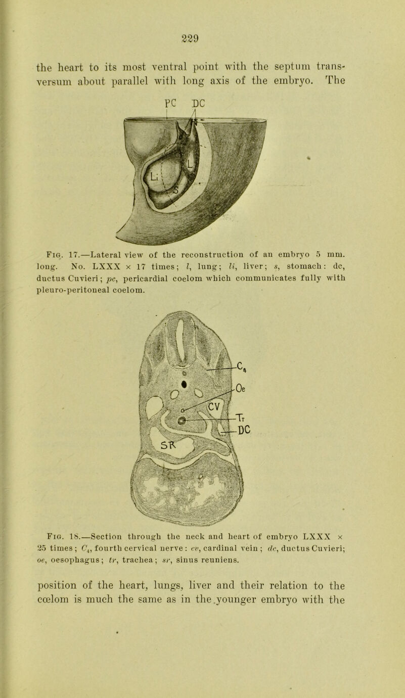 the heart to its most ventral point with the septum trans- versum about parallel with long axis of the embryo. The PC DC Fig. 17.—Lateral view of the reconstruction of an embryo 5 mm. long. No. LXXX x 17 times; l, lung; li, liver; s, stomach: dc, ductus Cuvieri; pc, pericardial coelom which communicates fully with pleuro-peritoneal coelom. Fig. 18.—Section through the neck and heart of embryo LXXX x 25 times; C\, fourth cervical nerve: cv, cardinal vein; dc, ductus Cuvieri; oe, oesophagus; tr, trachea; sr, sinus reuniens. position of the heart, lungs, liver and their relation to the ccelom is much the same as in the.younger embryo with the